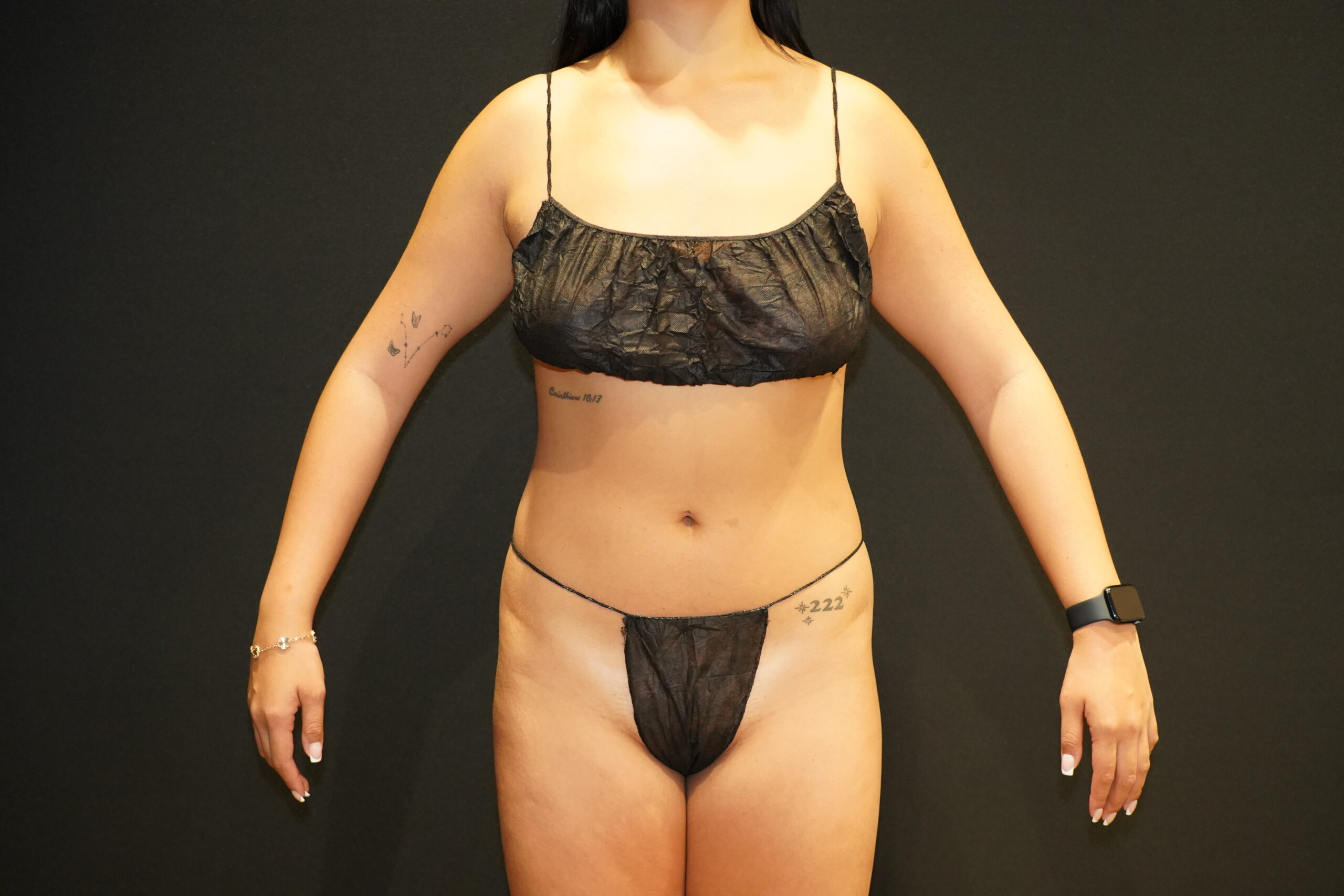 Patient Result Before Photo