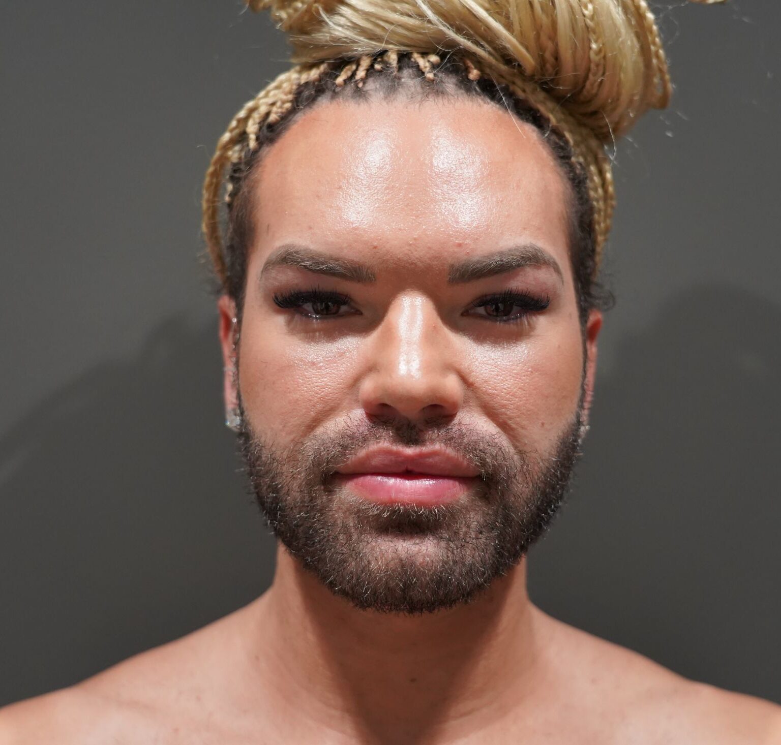 After photo - 0° view