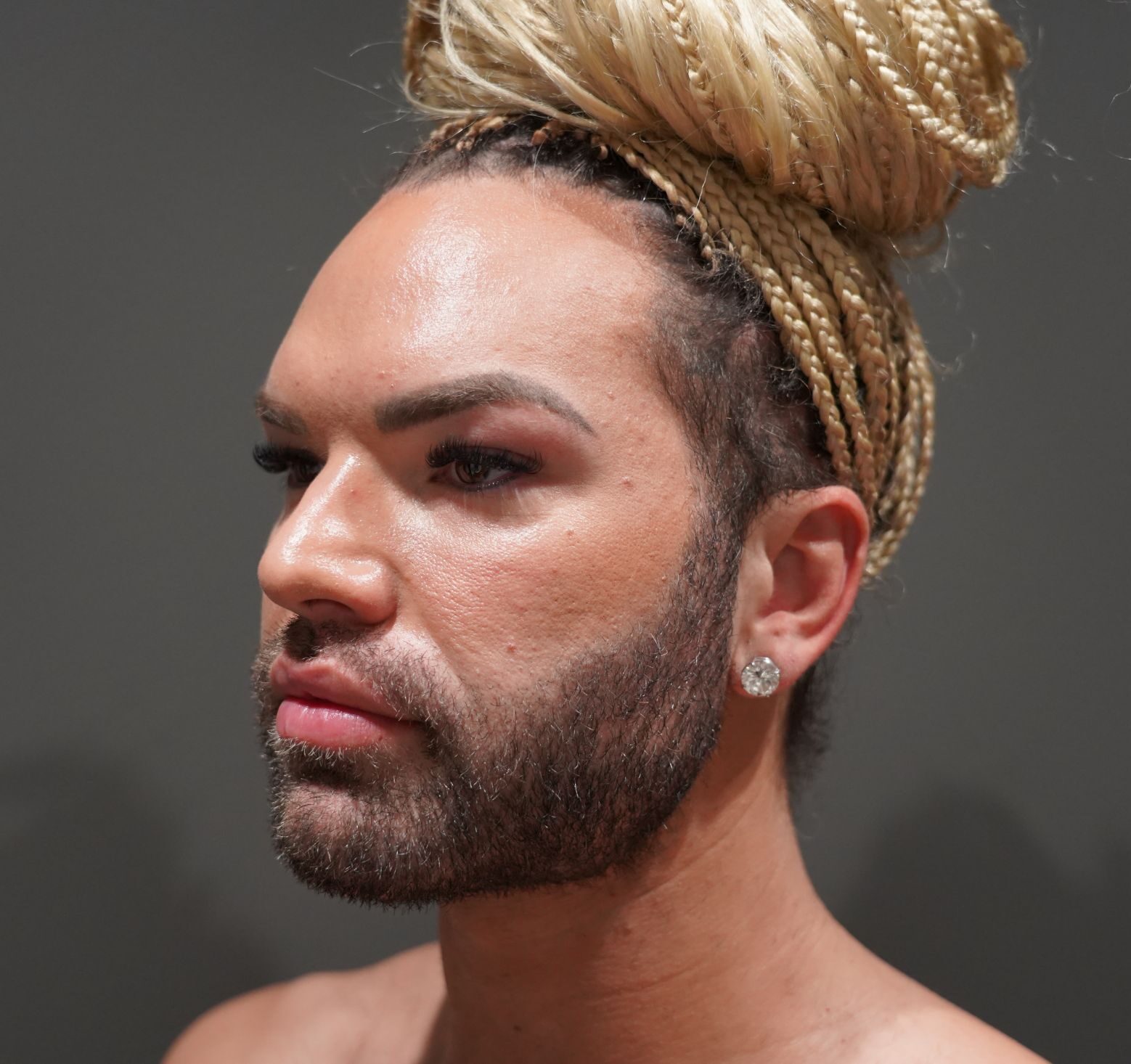 After photo - -45° view