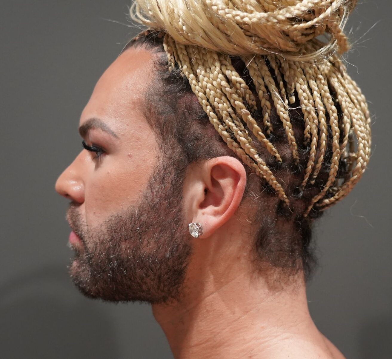 After photo - -90° view