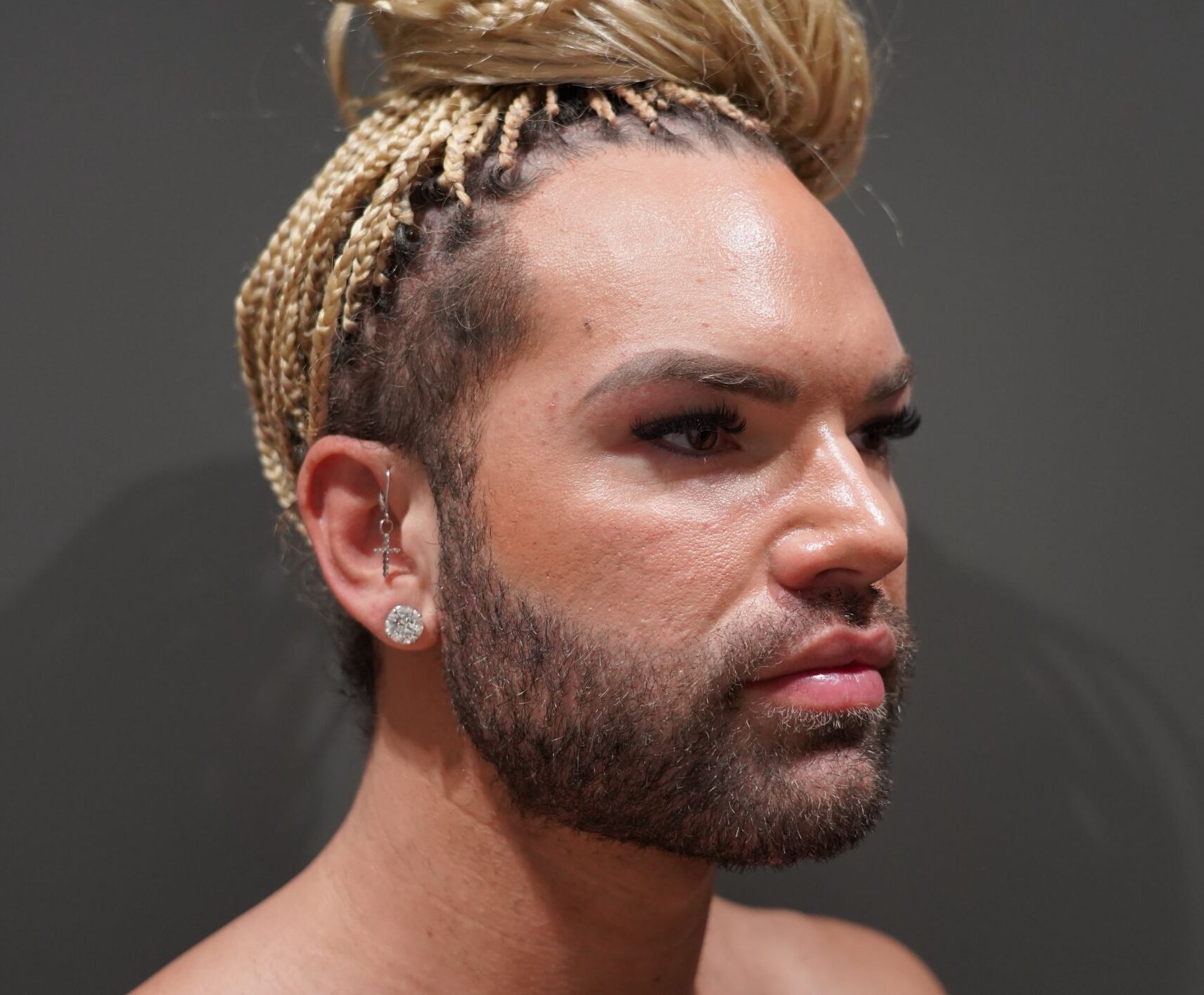 After photo - 45° view