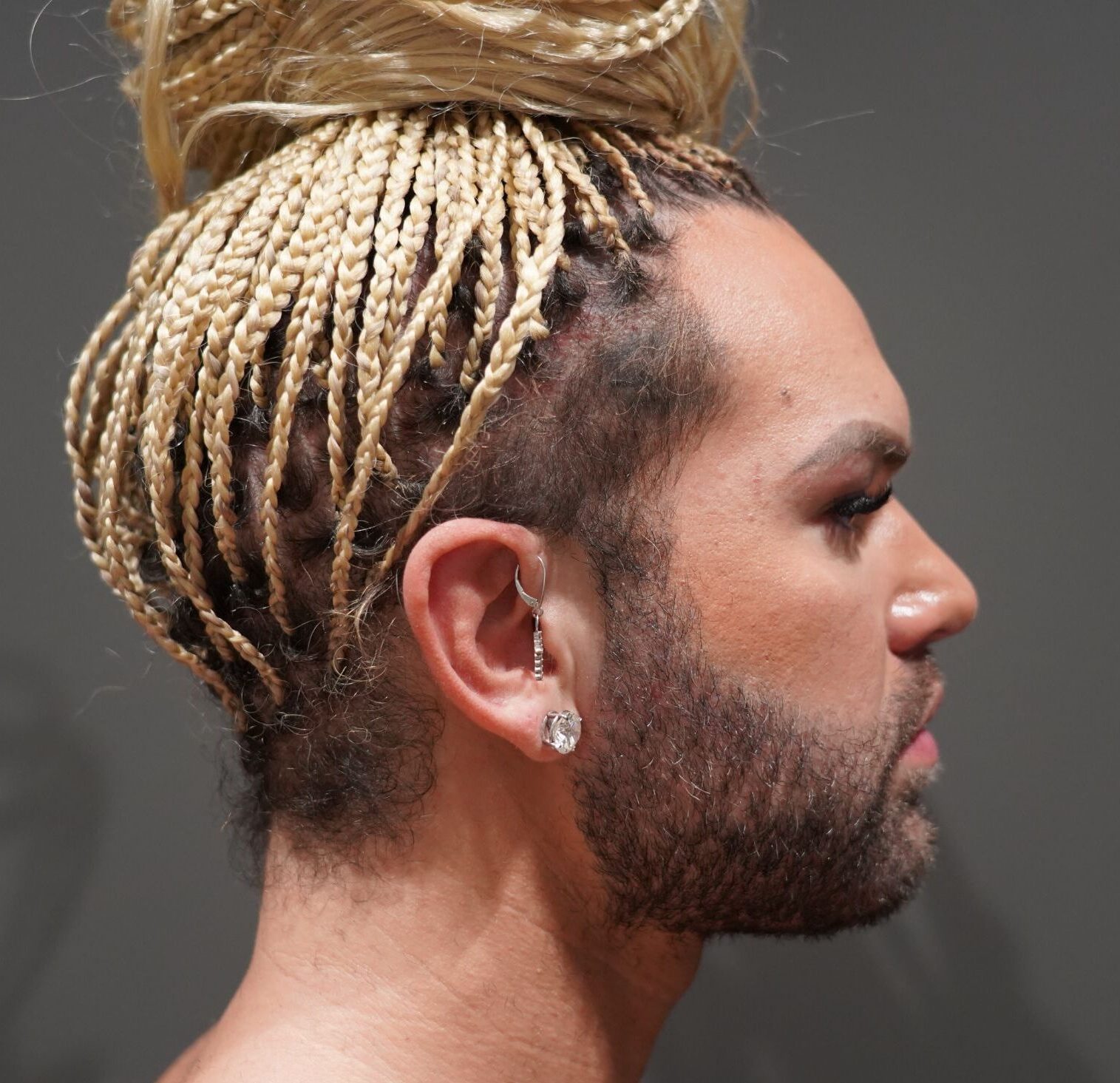 After photo - 90° view