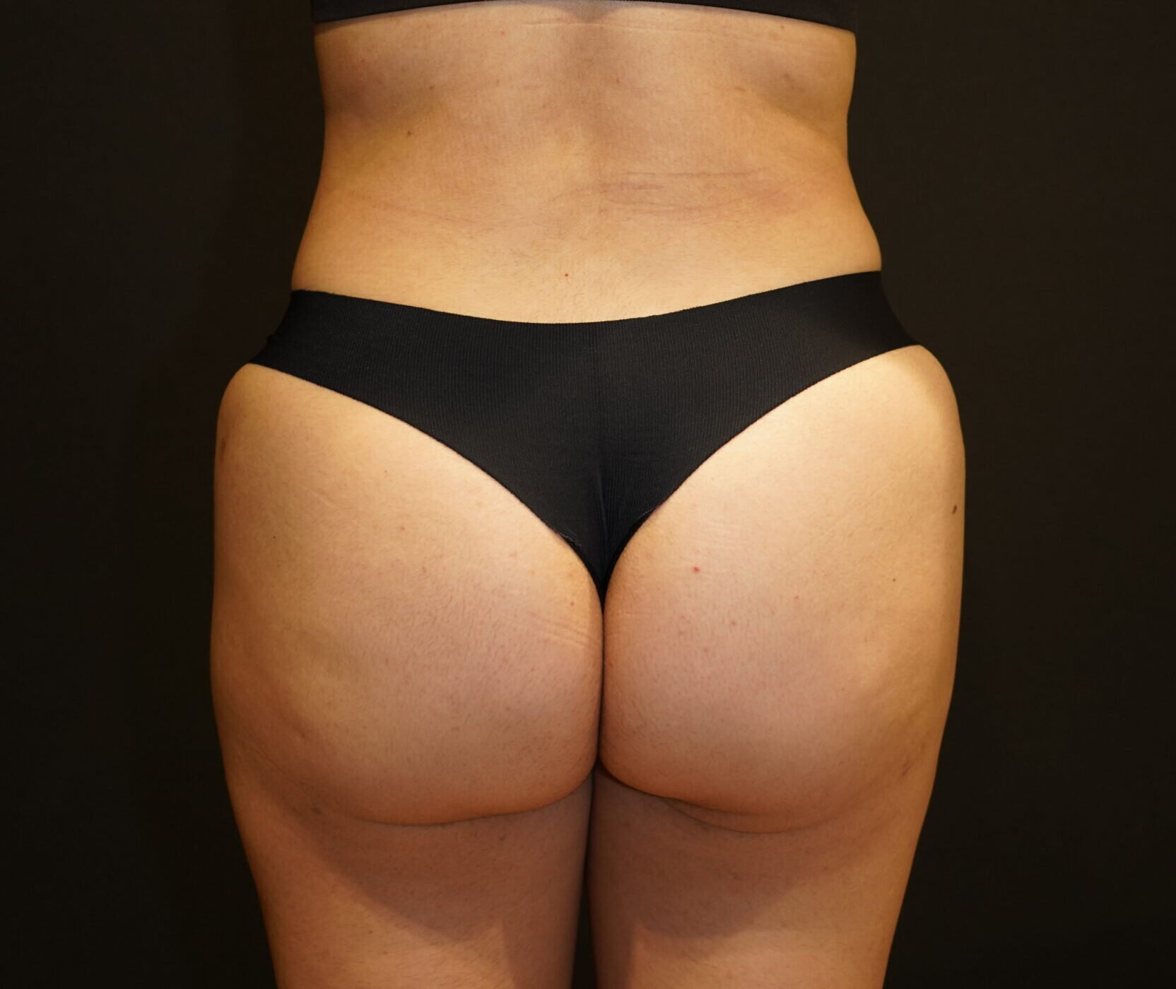 After photo - 180° view