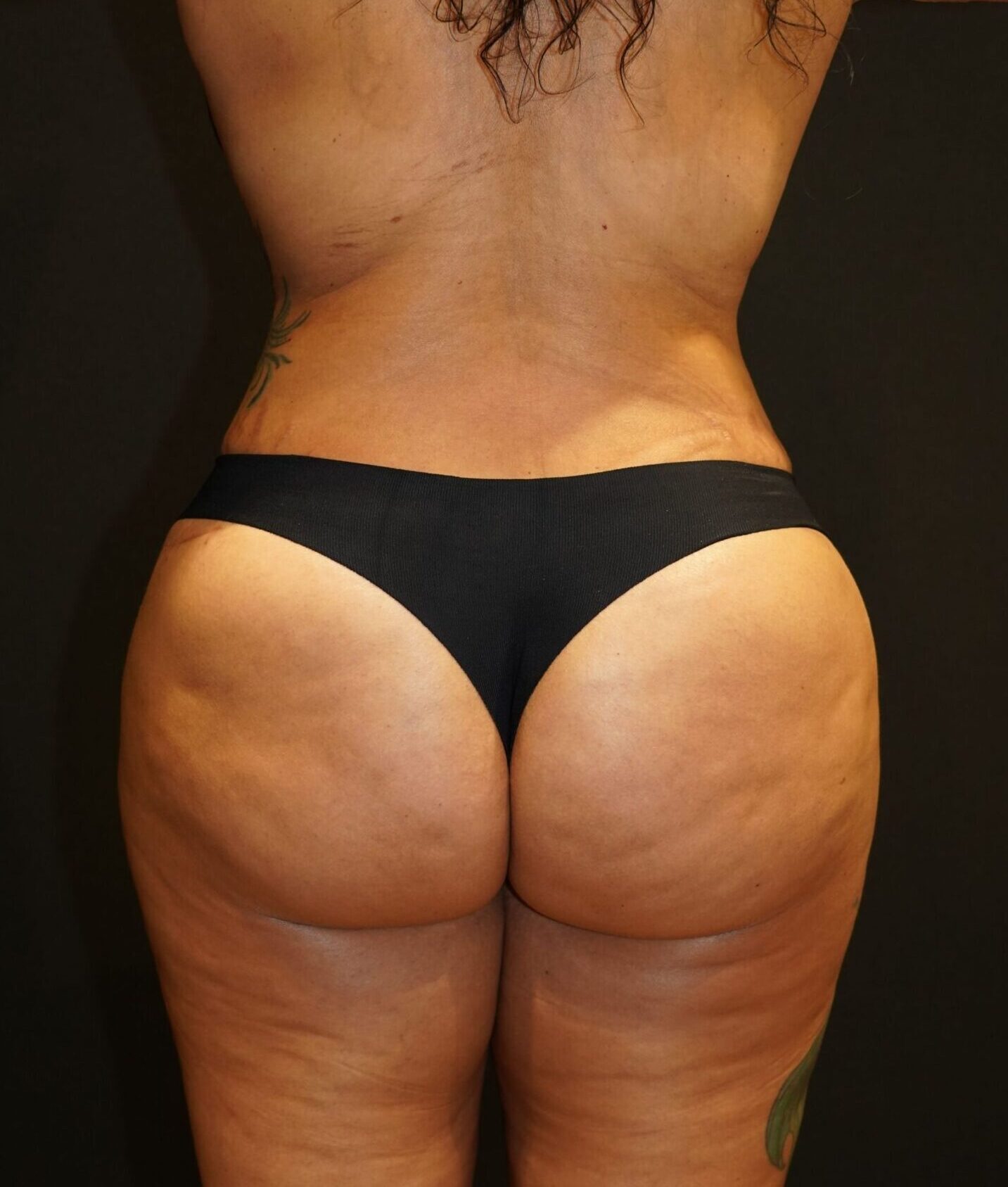 After photo - 180° view