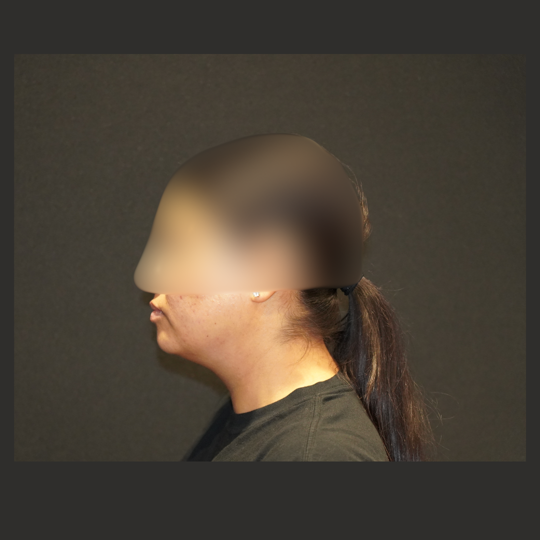 Case--1204 | Before Face Procedures