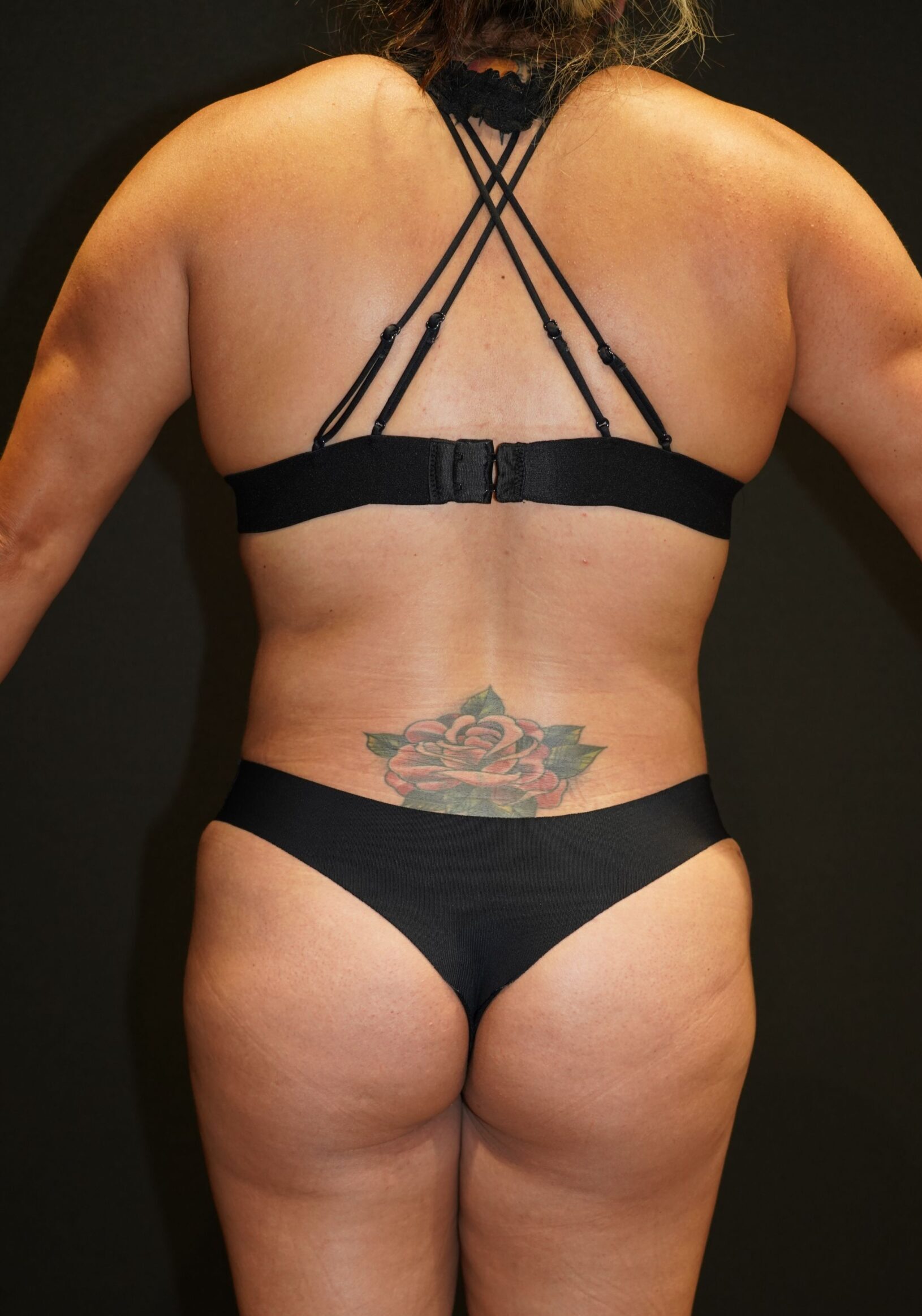 After photo - 180° view