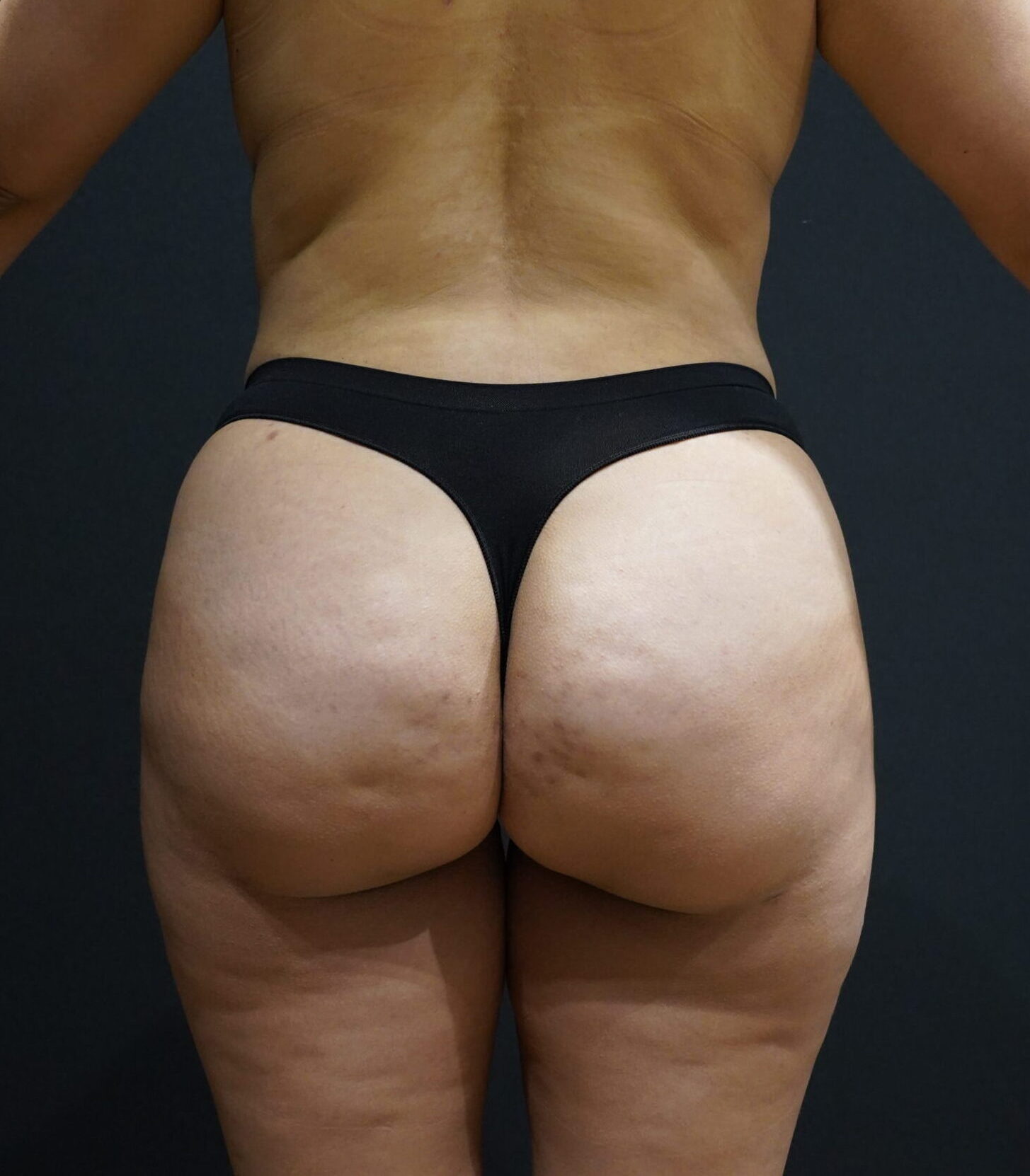 After photo - 180° view