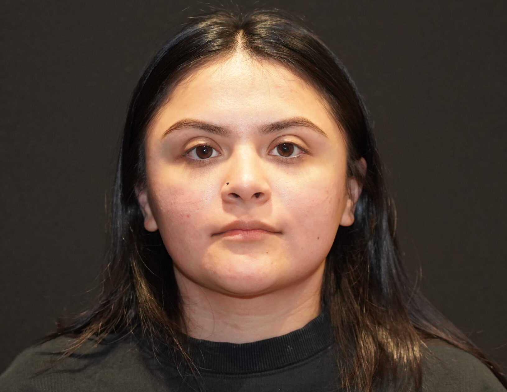 After photo - 0° view