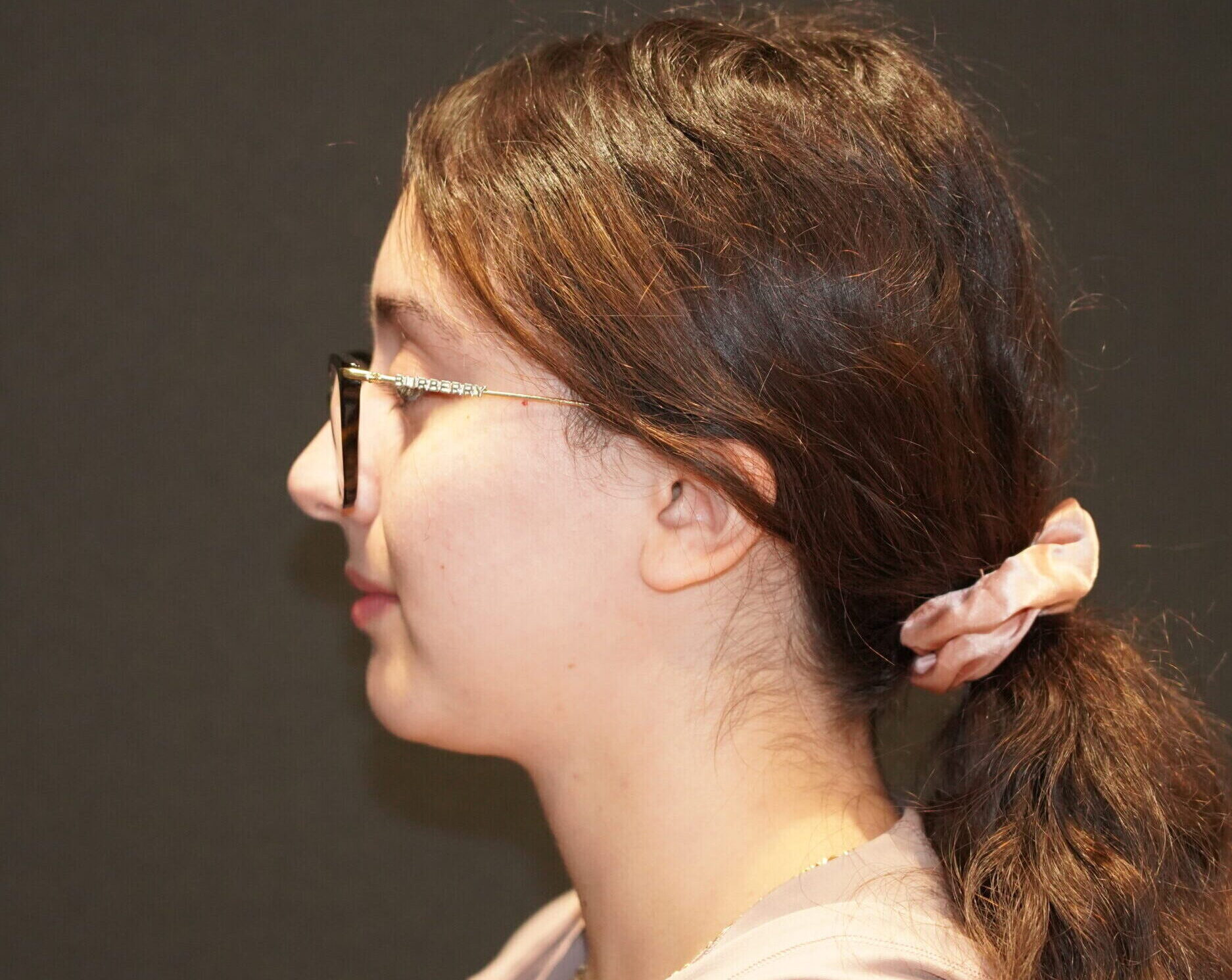 After photo - -90° view