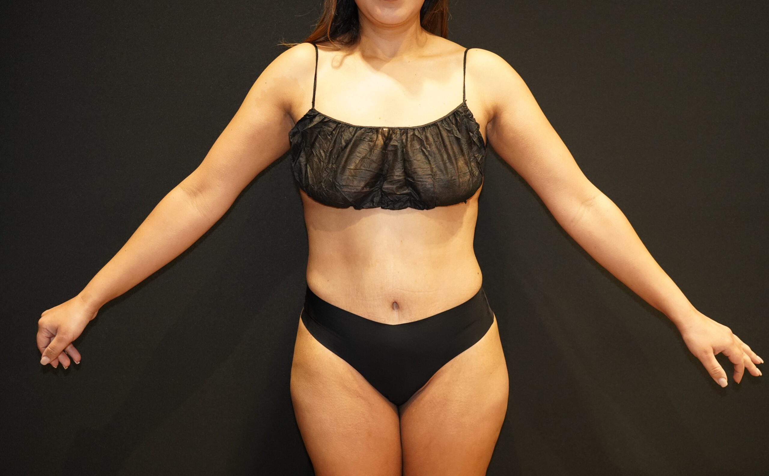 Case--8487 | After Body Procedures