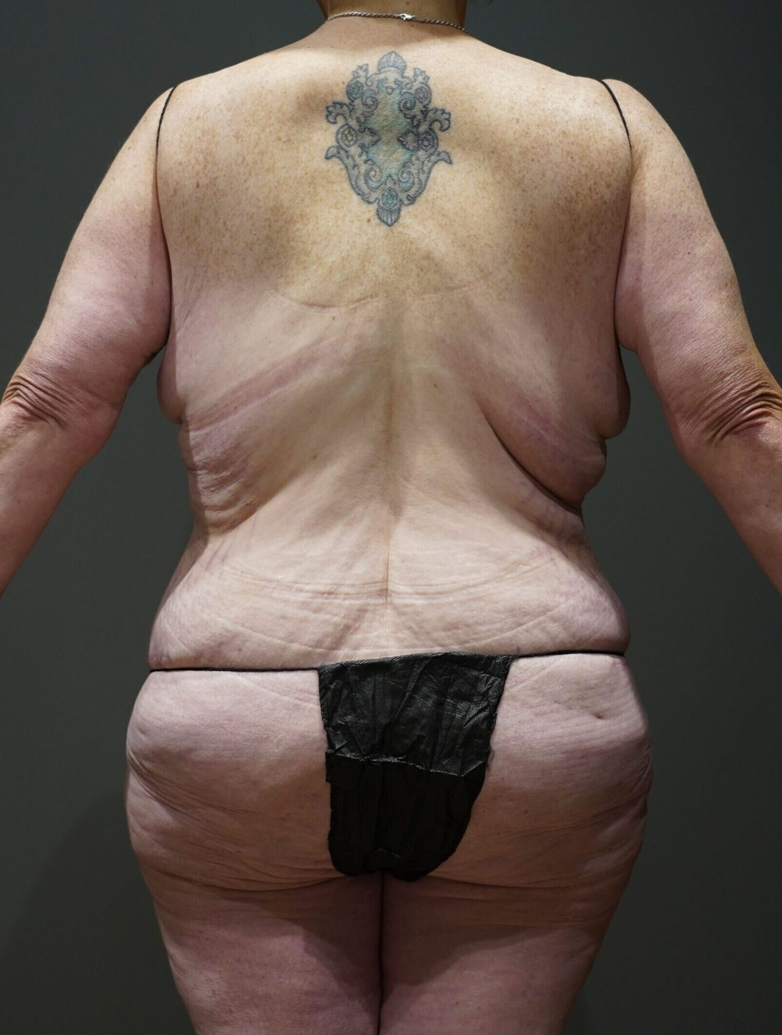 After photo - 180° view