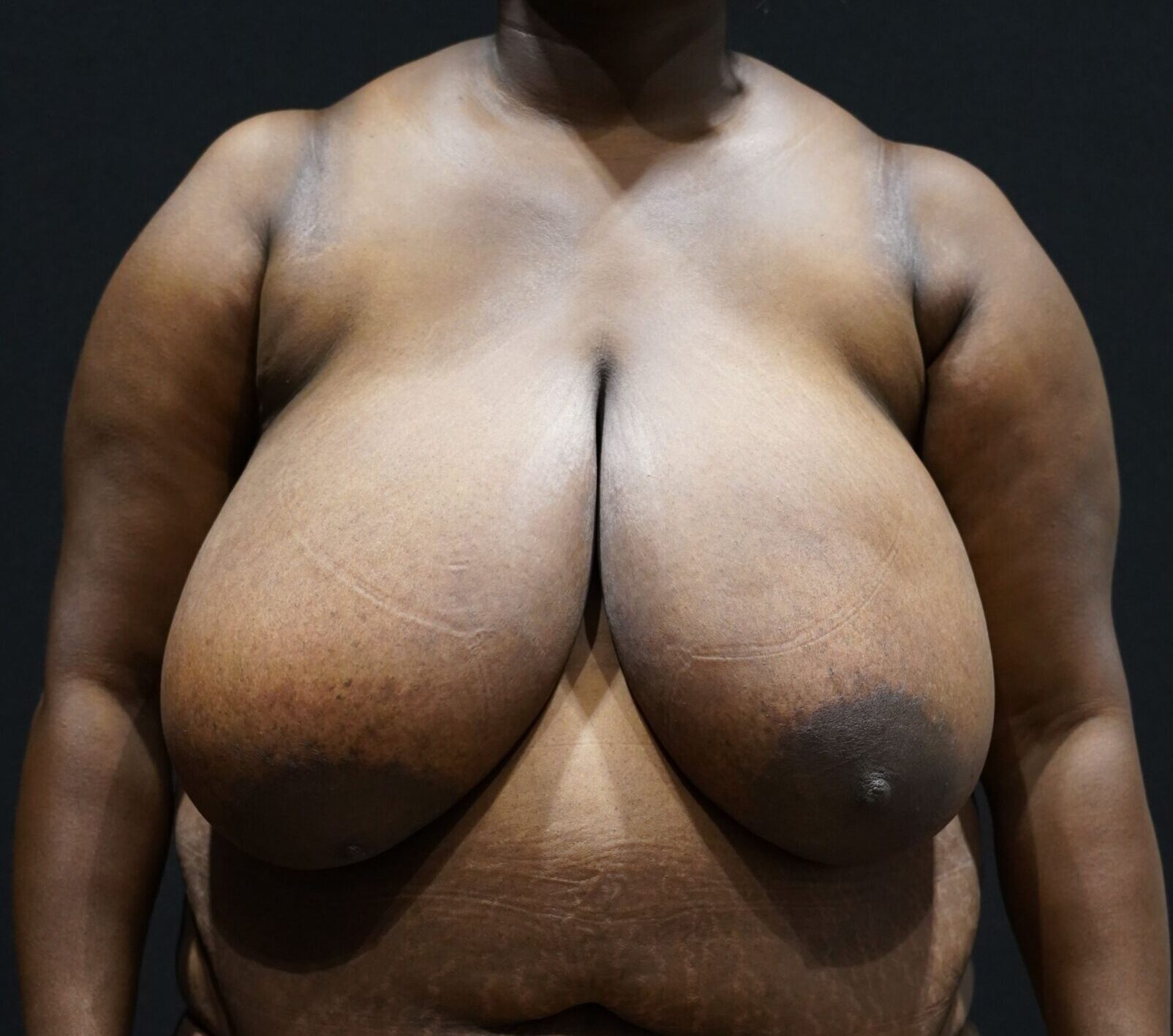 Before photo - 0° view