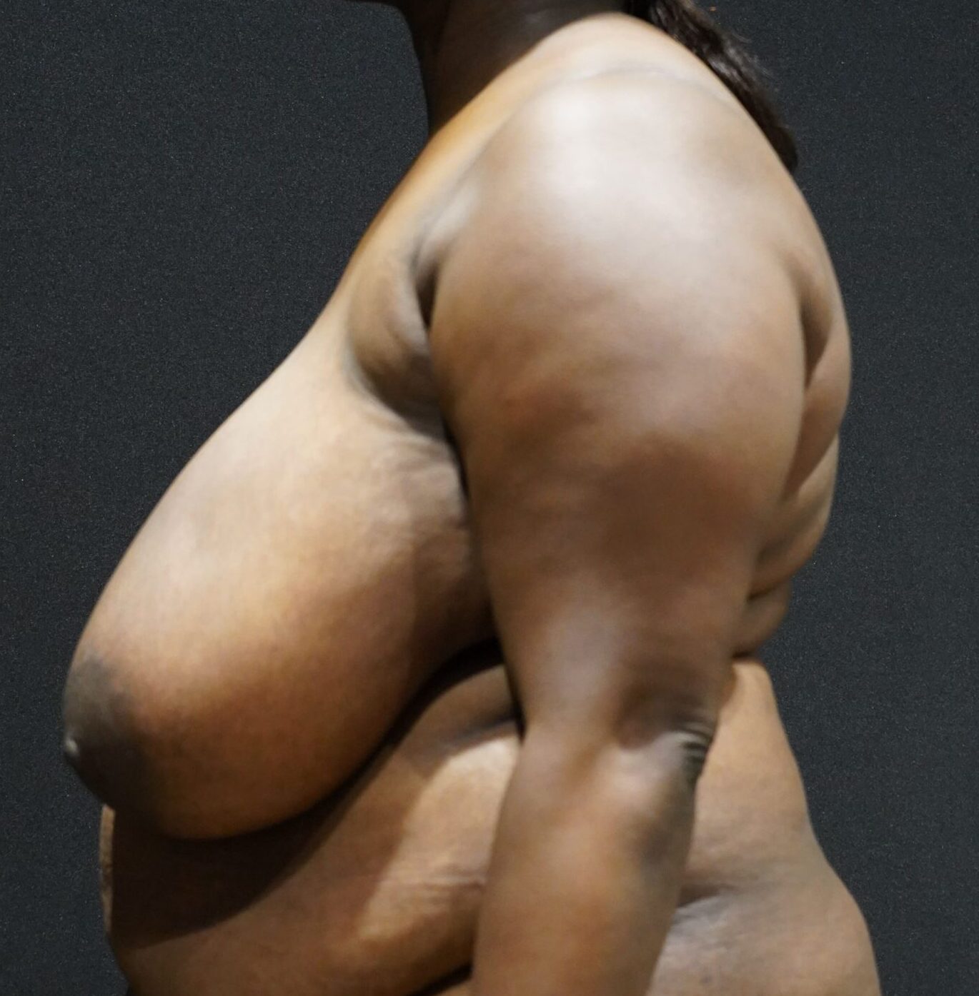 Before photo - -90° view