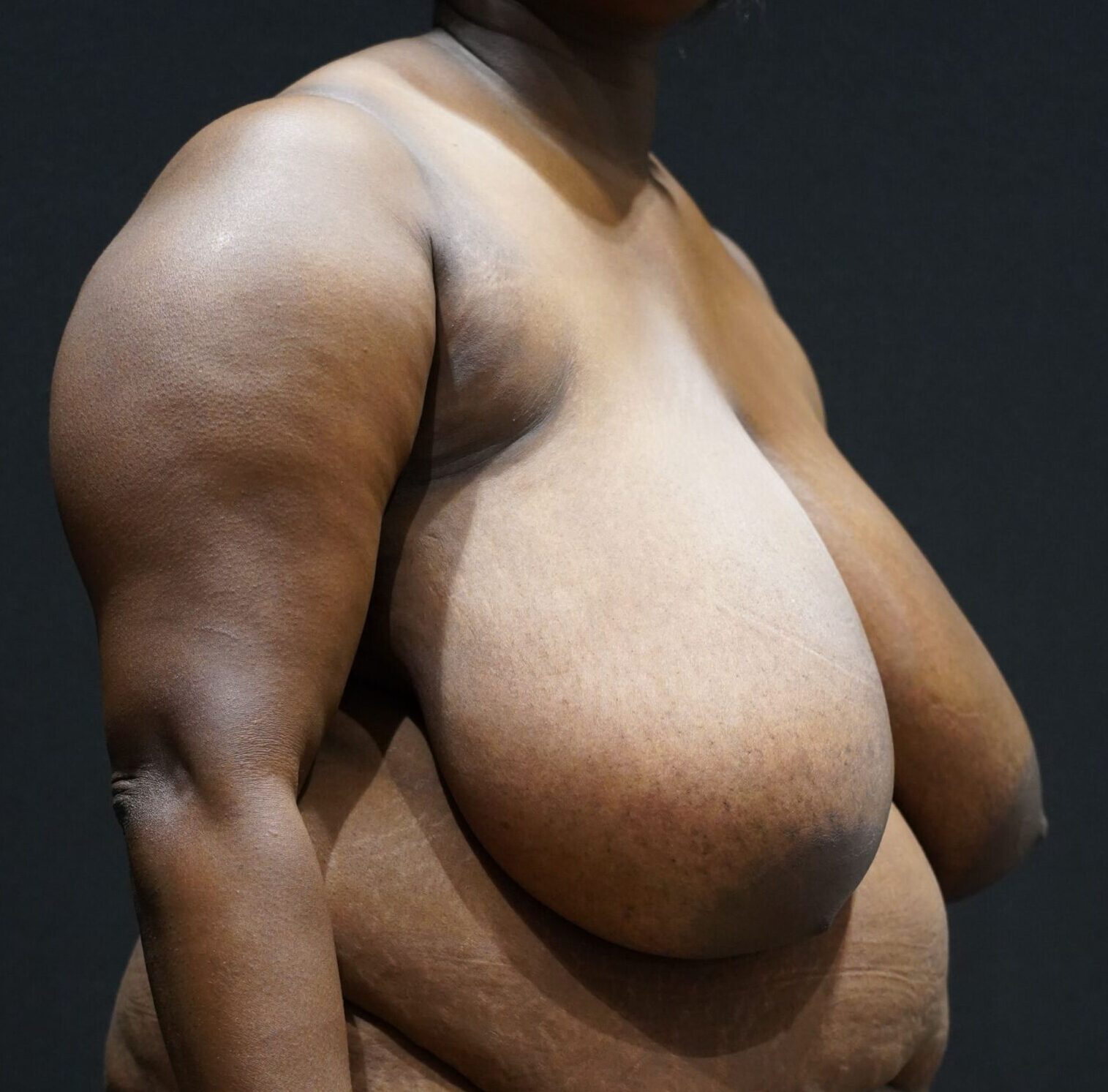 Before photo - 45° view