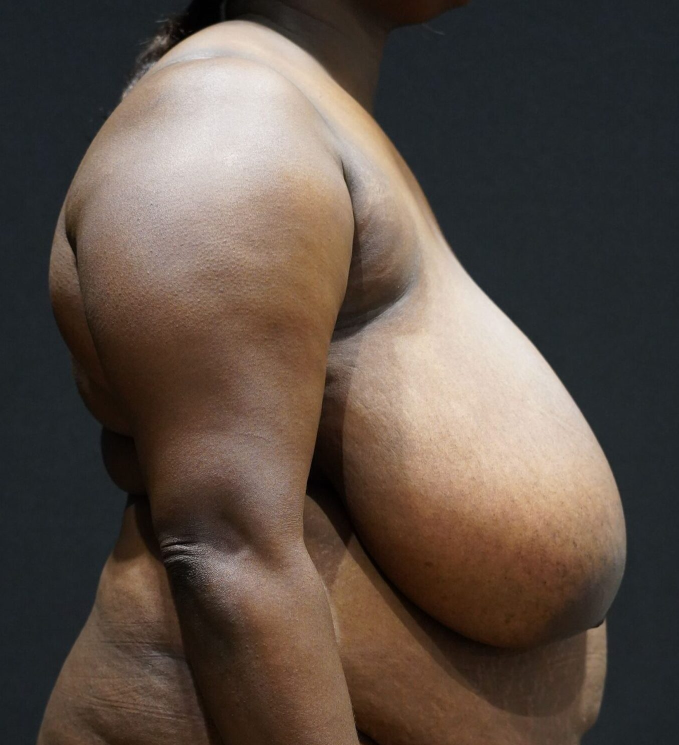 Before photo - 90° view