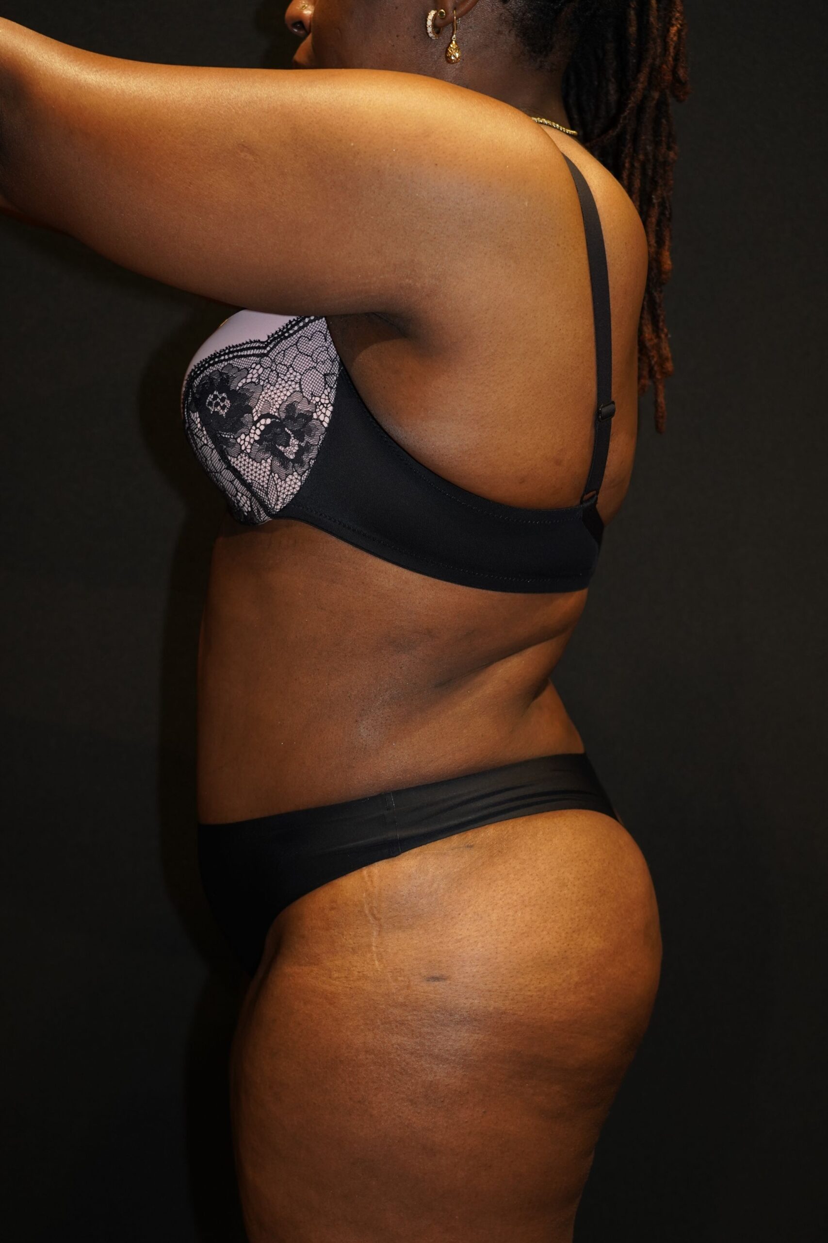 After photo - -90° view