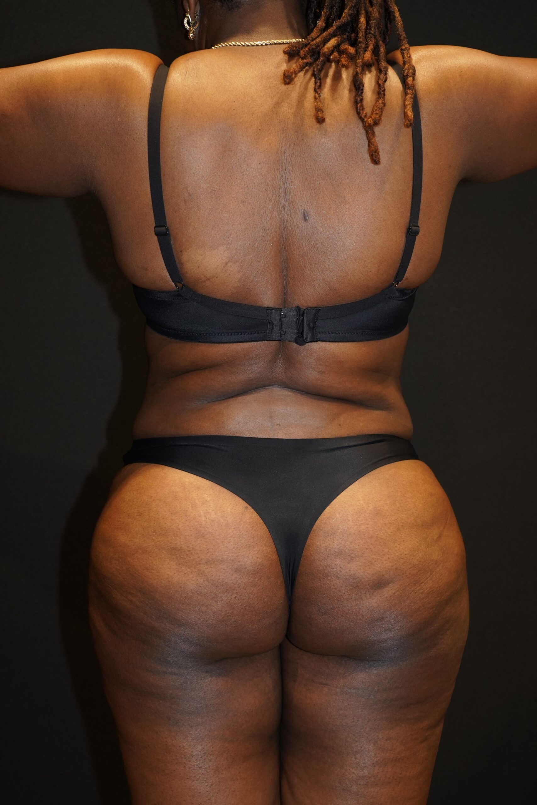 After photo - 180° view