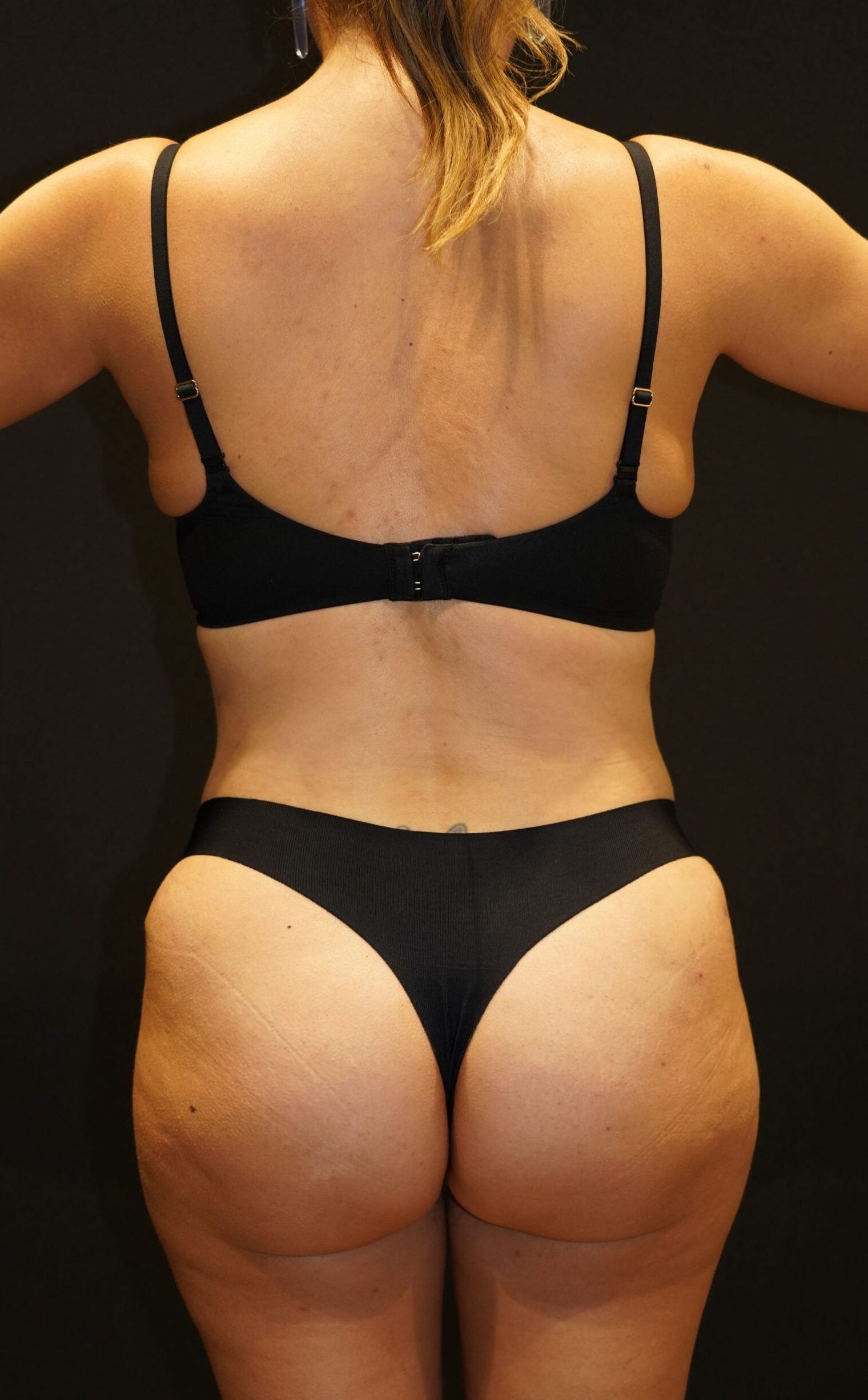 After photo - 180° view