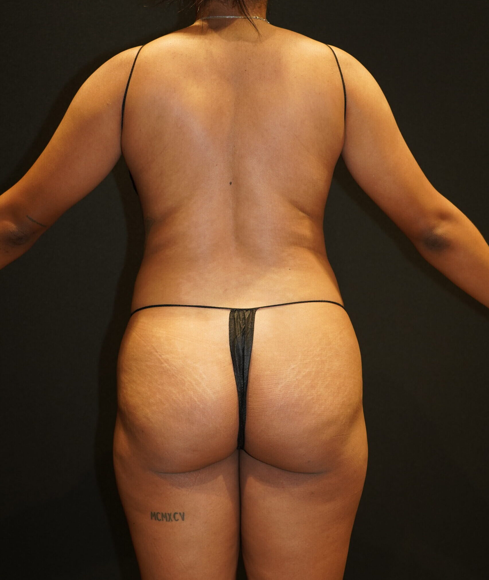 Before photo - 180° view