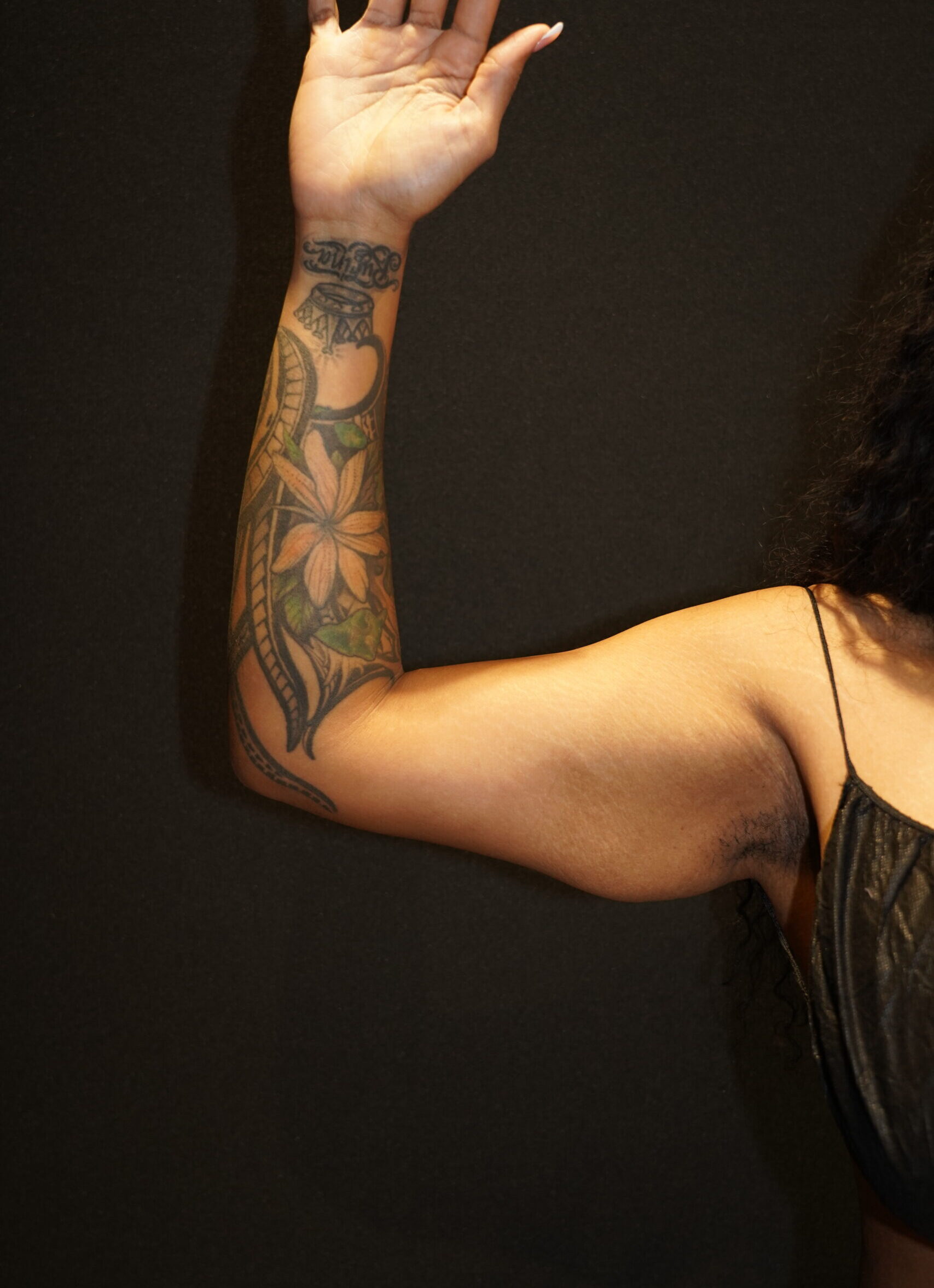 Before photo - 0° view