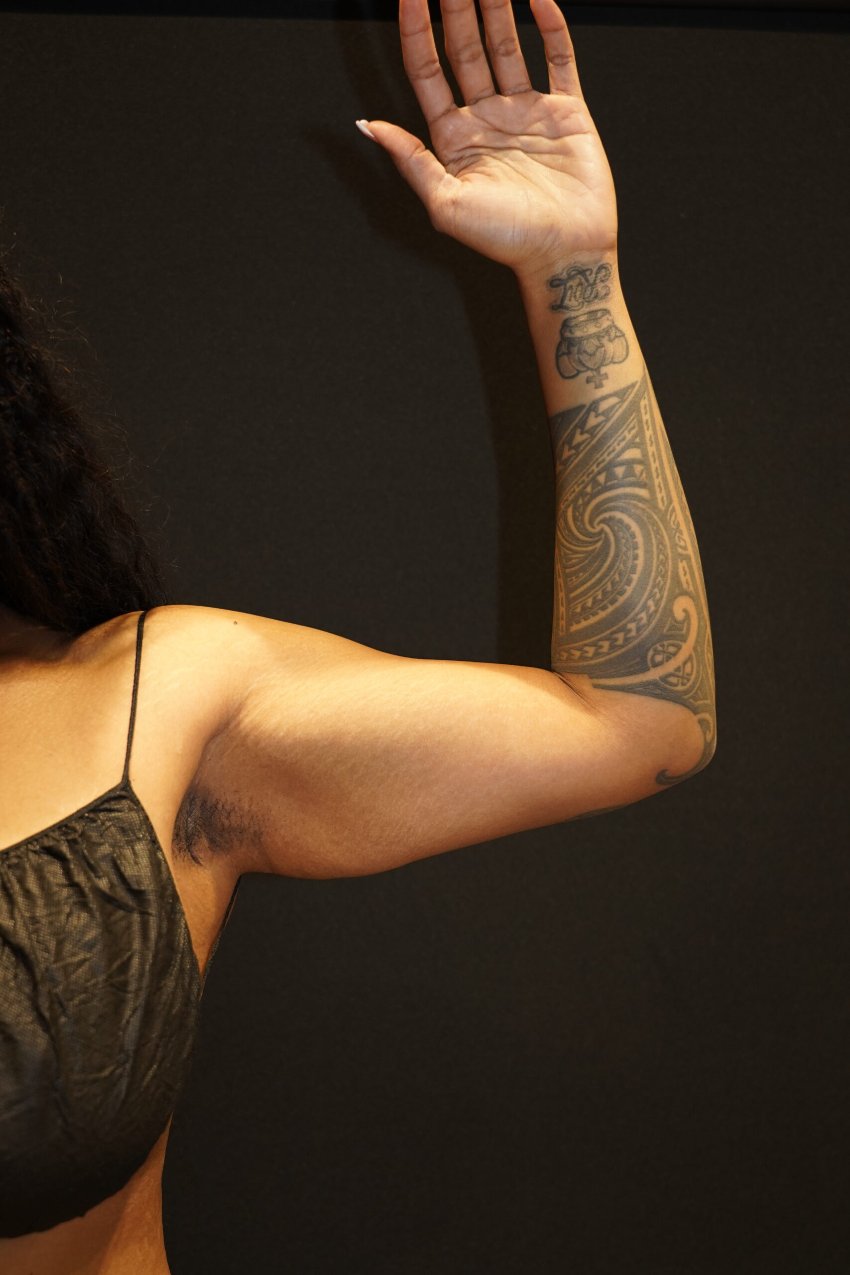 Before photo - 90° view