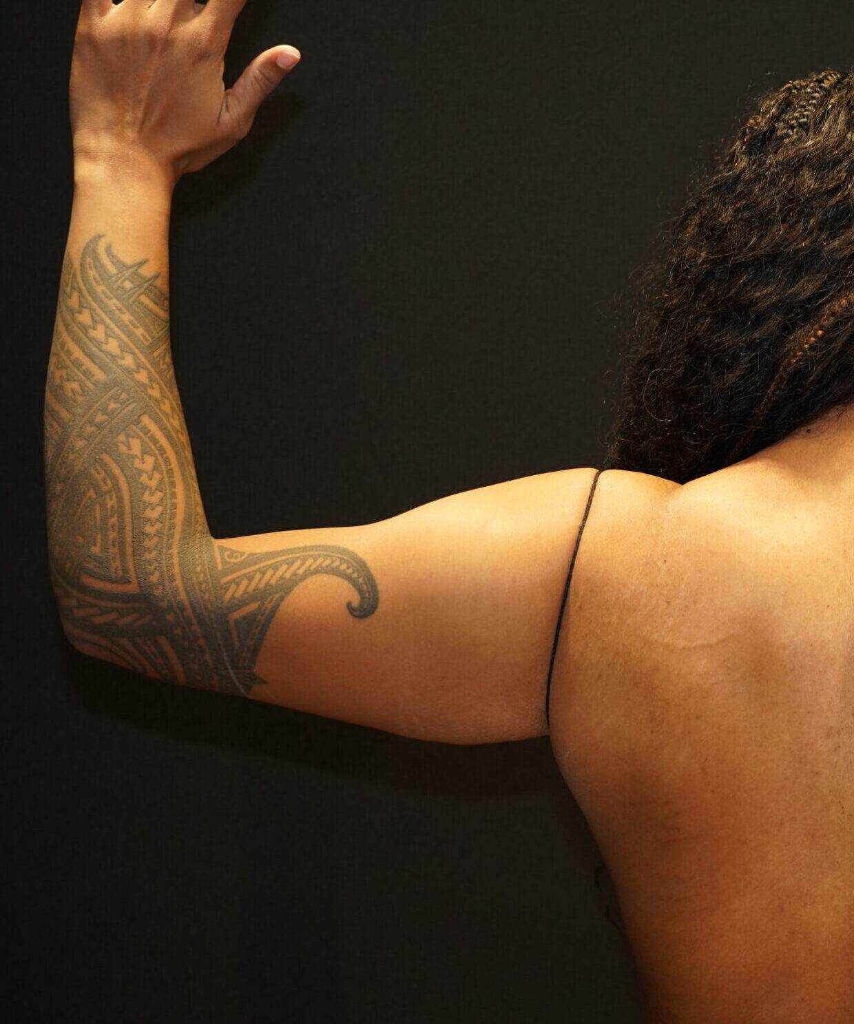 Before photo - 180° view