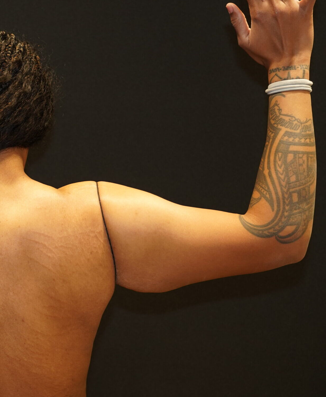 Before photo - -90° view