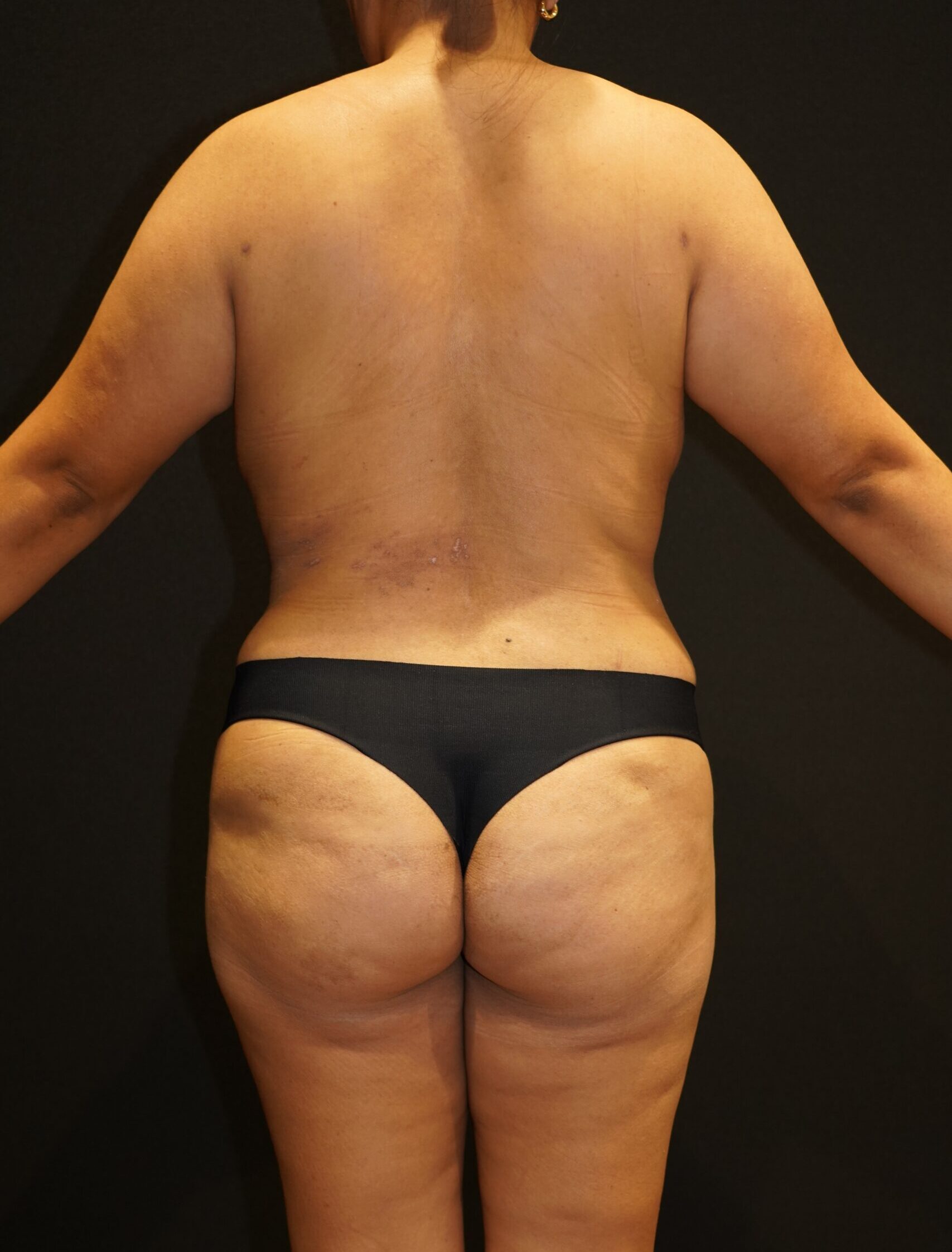 After photo - 180° view