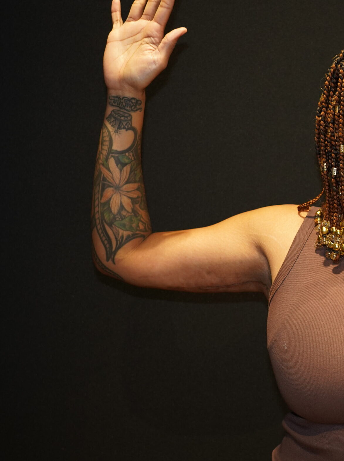 After photo - 0° view