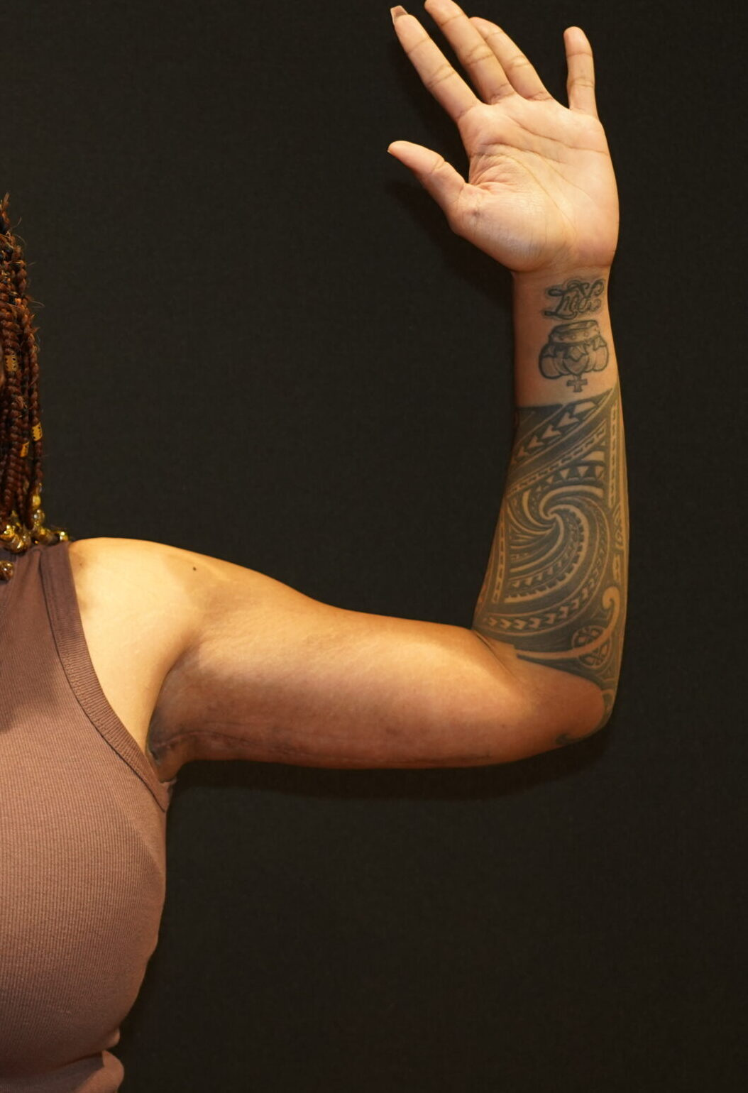 After photo - 90° view