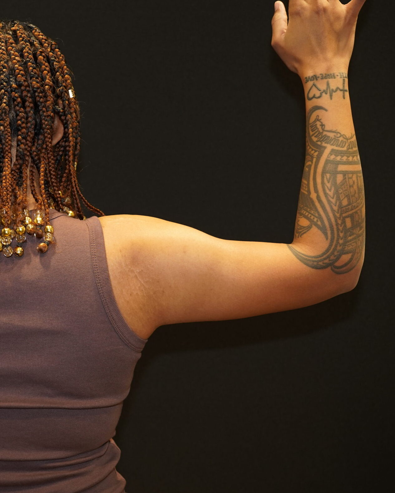 After photo - -90° view