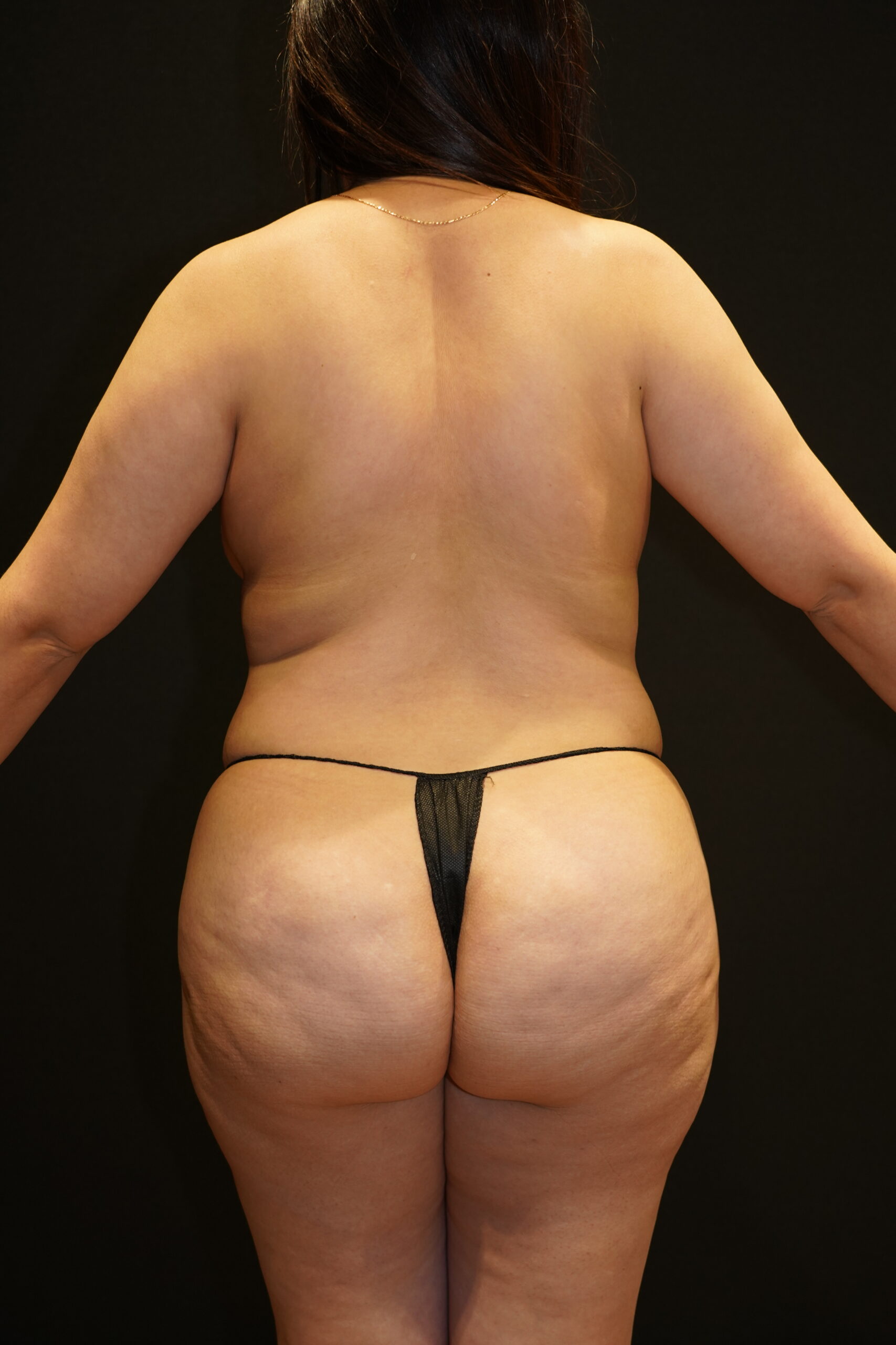 Before photo - 180° view