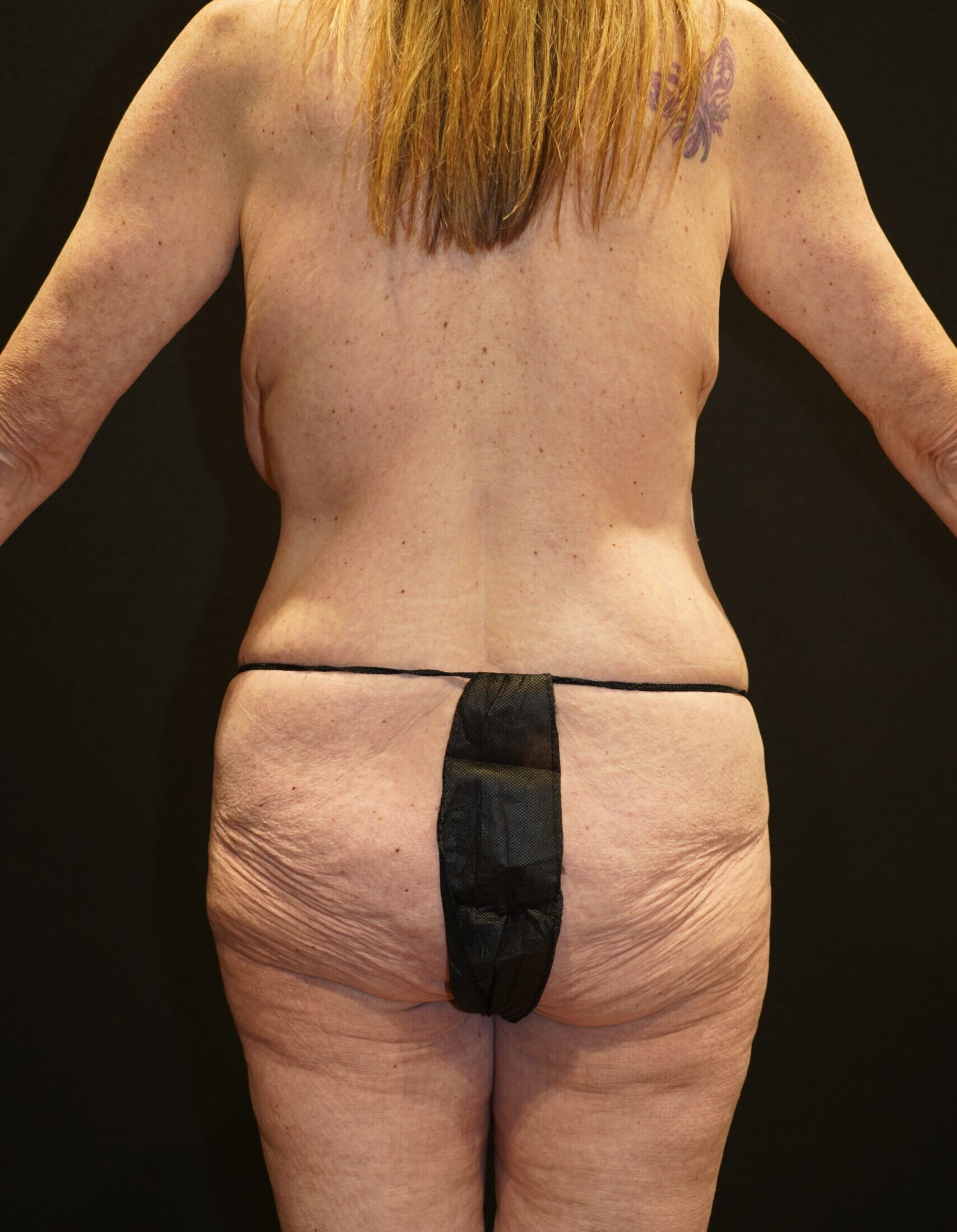 Before photo - 180° view