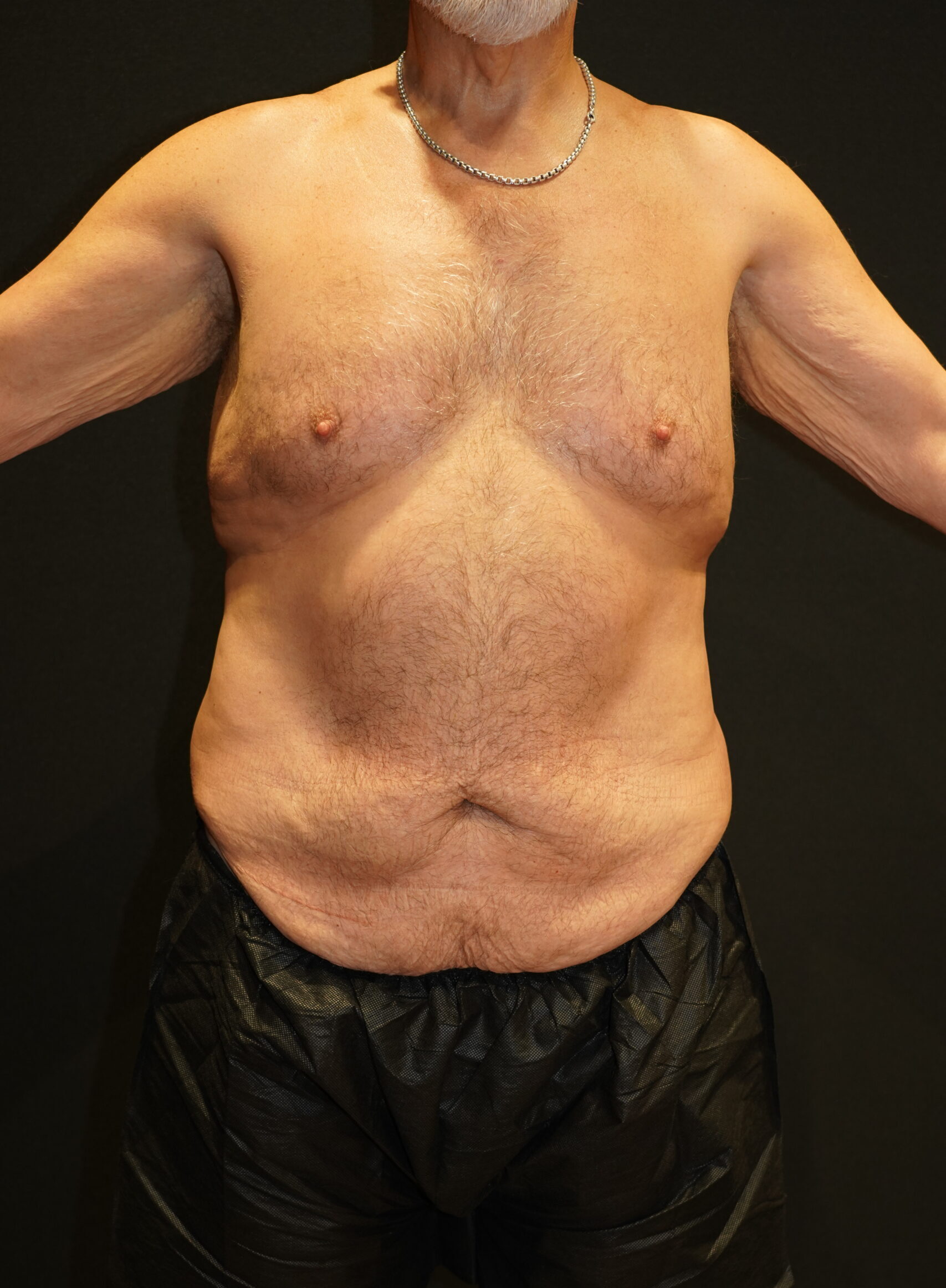 Before photo - 0° view