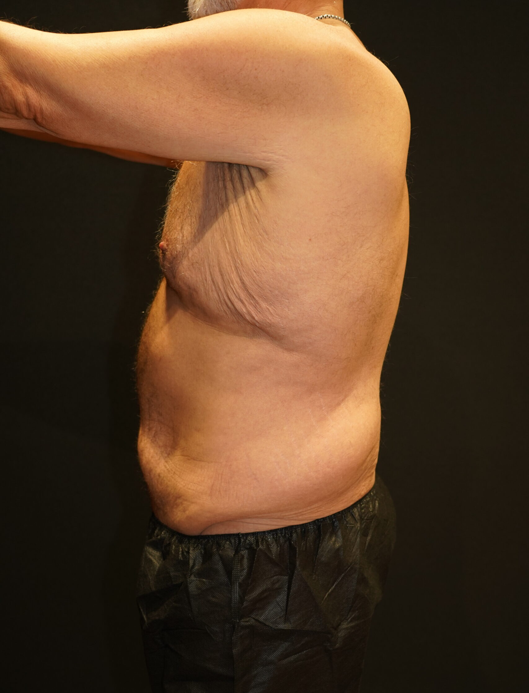 Before photo - 90° view