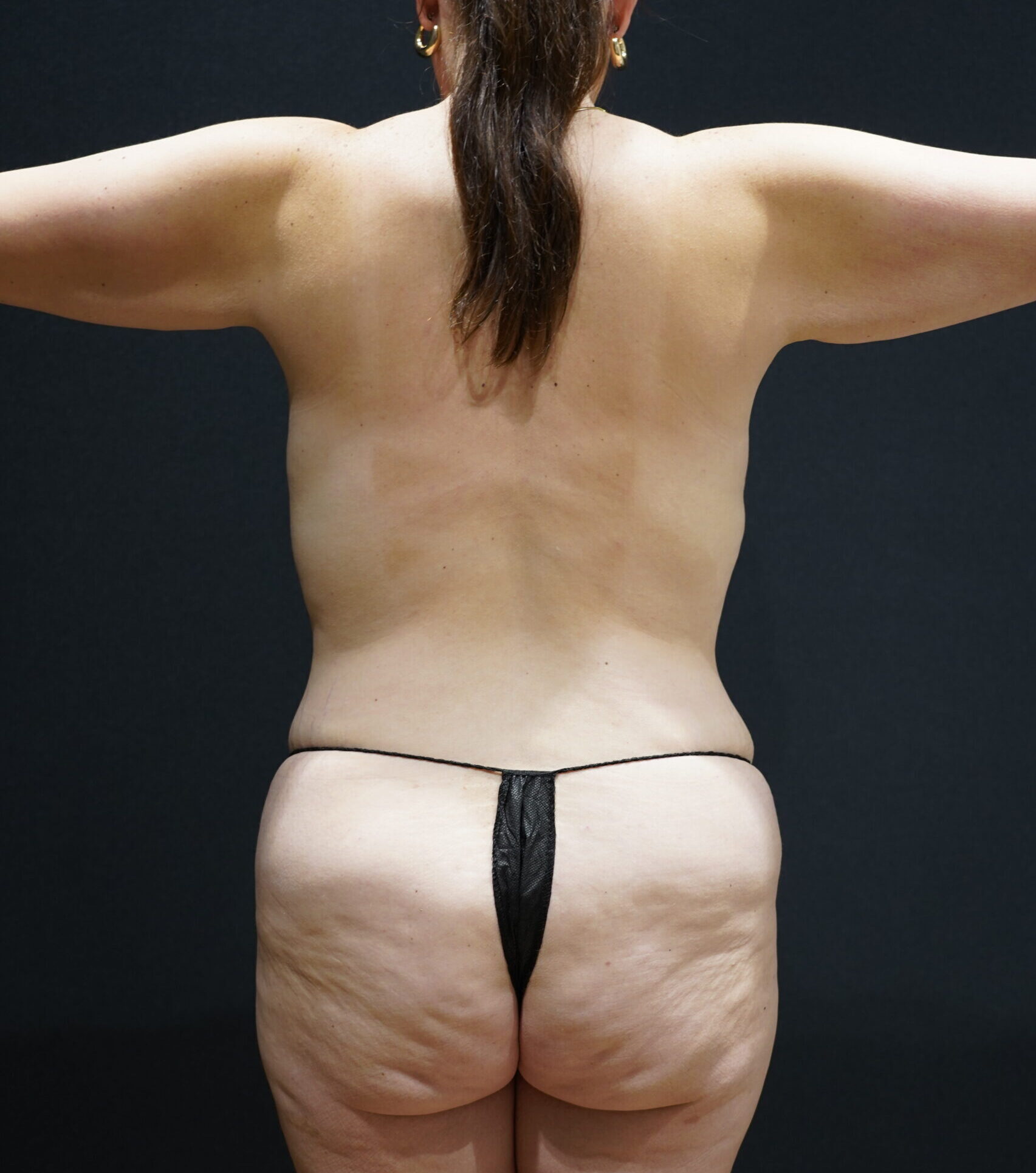 Before photo - 180° view