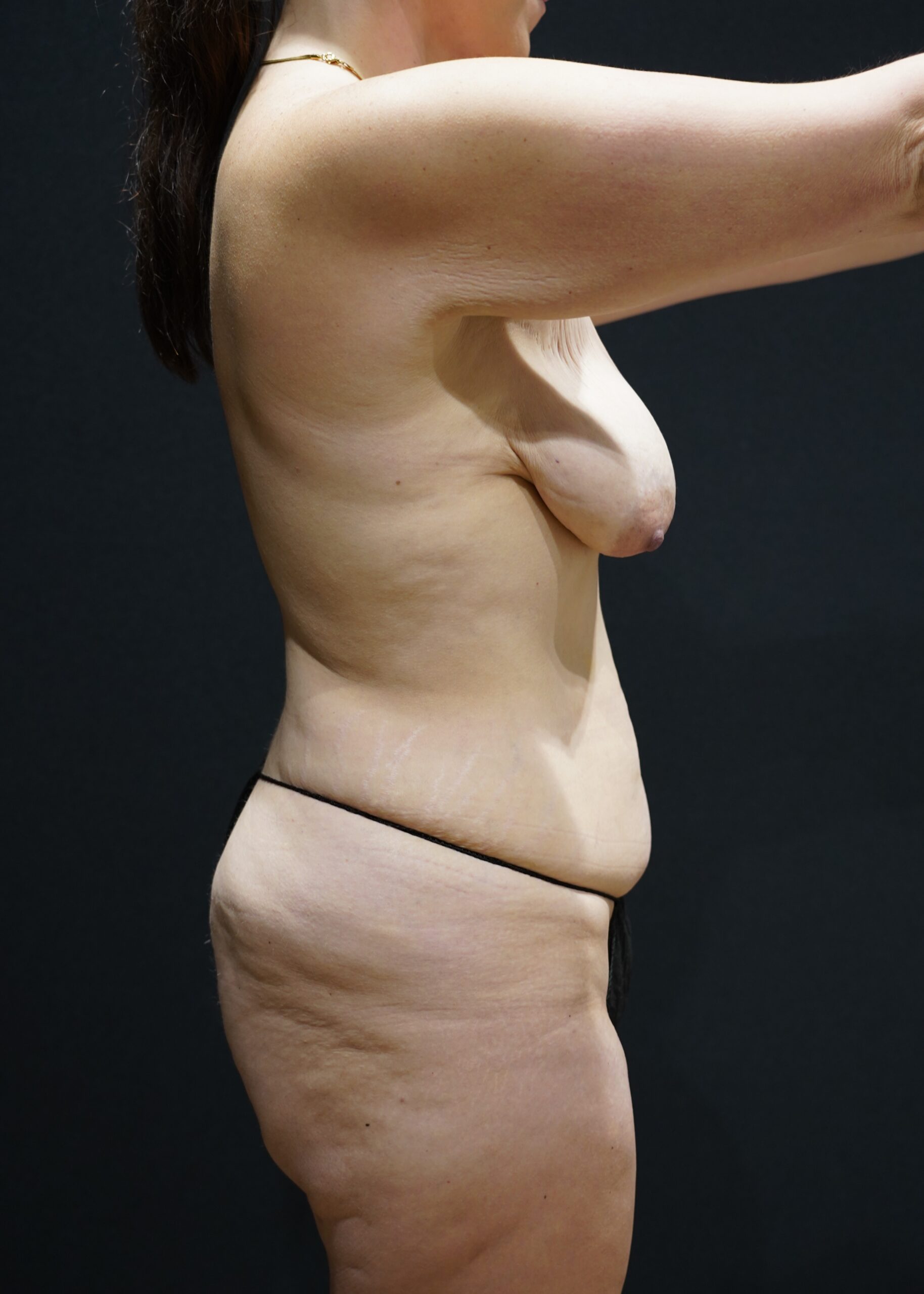 Before photo - 90° view