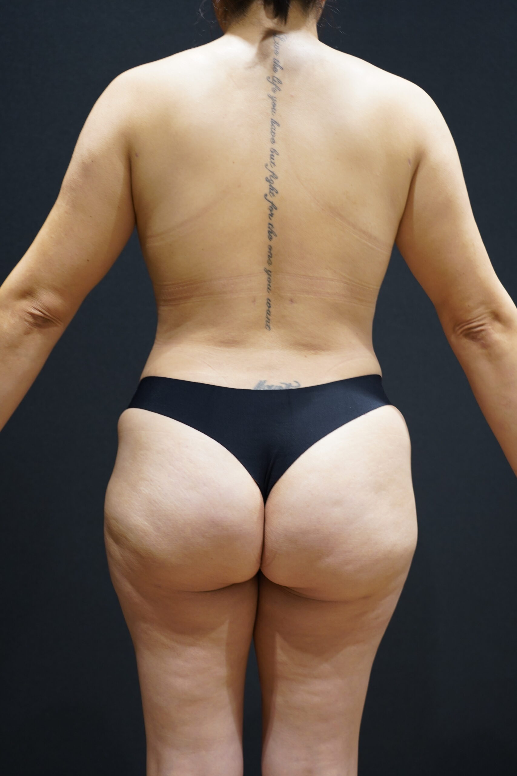 After photo - 180° view