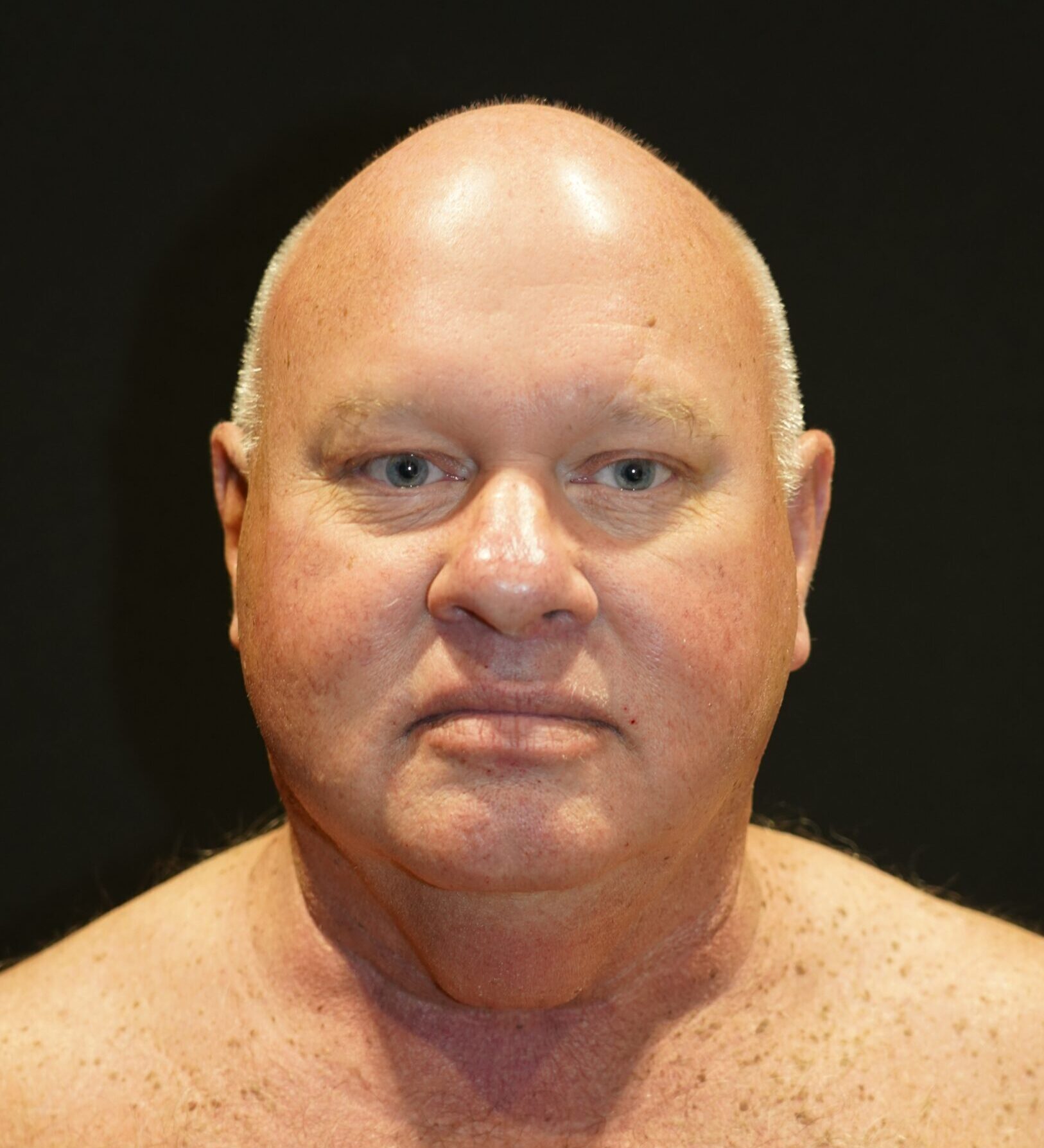 Before photo - 0° view