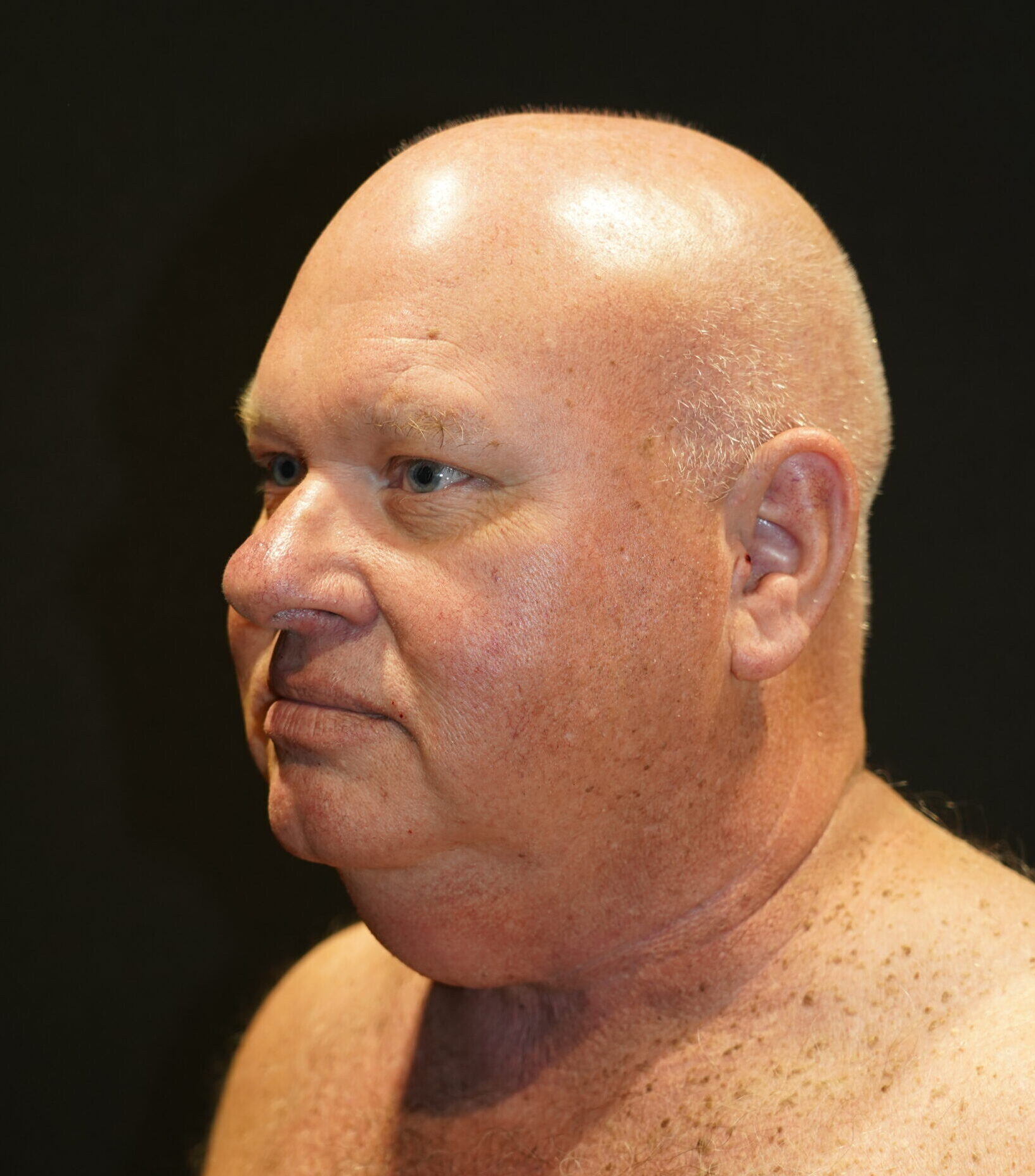 Before photo - 45° view