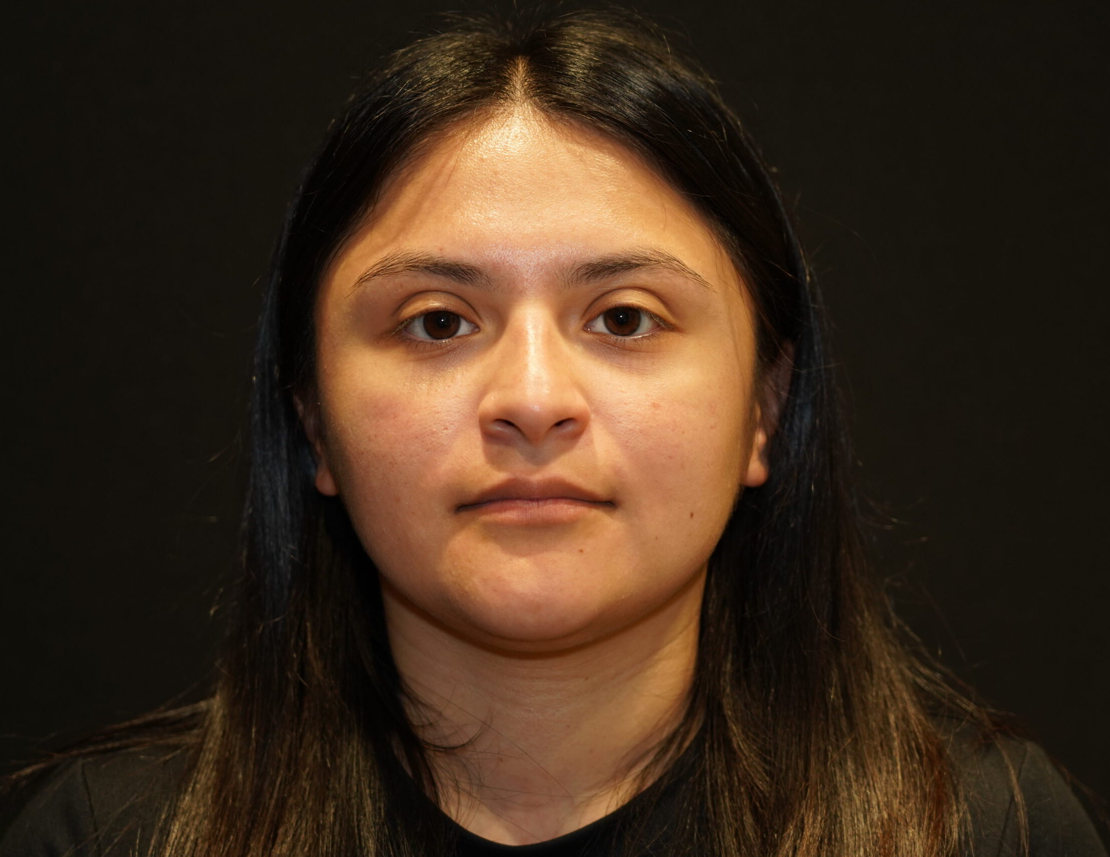 Before photo - 0° view