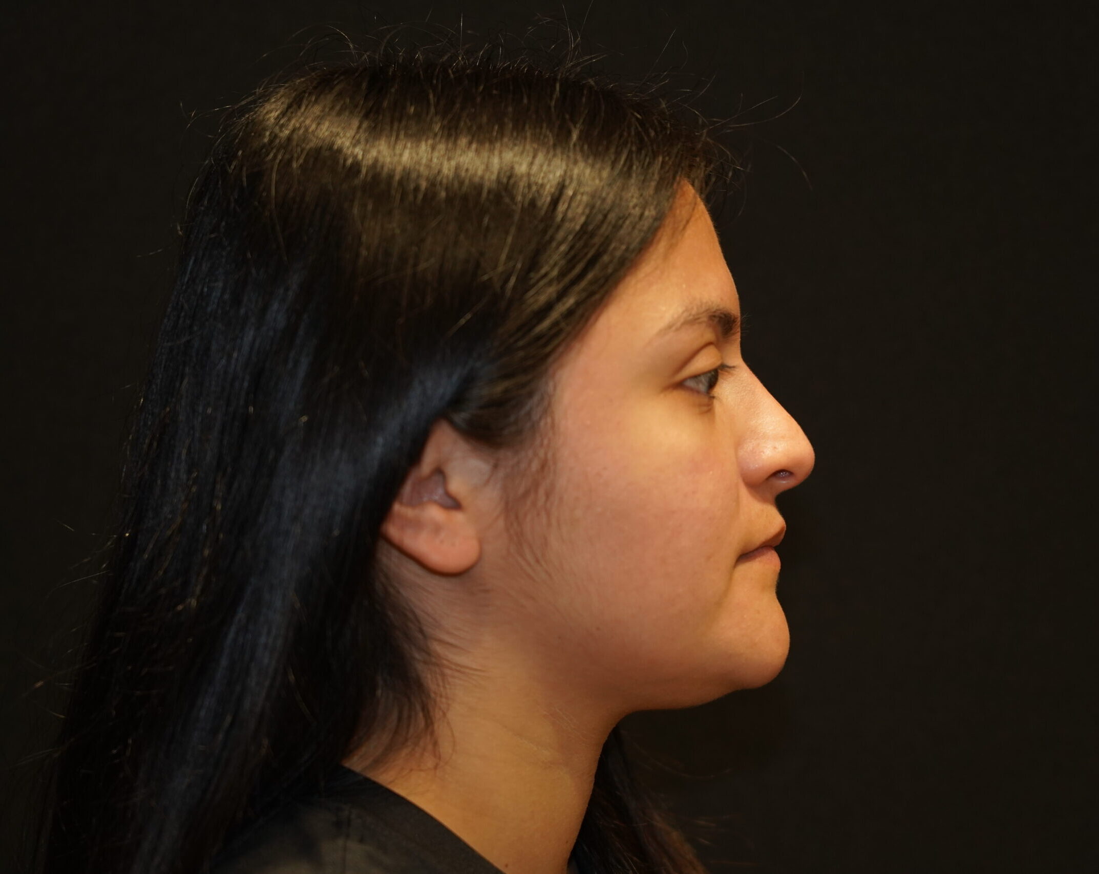 Before photo - 90° view