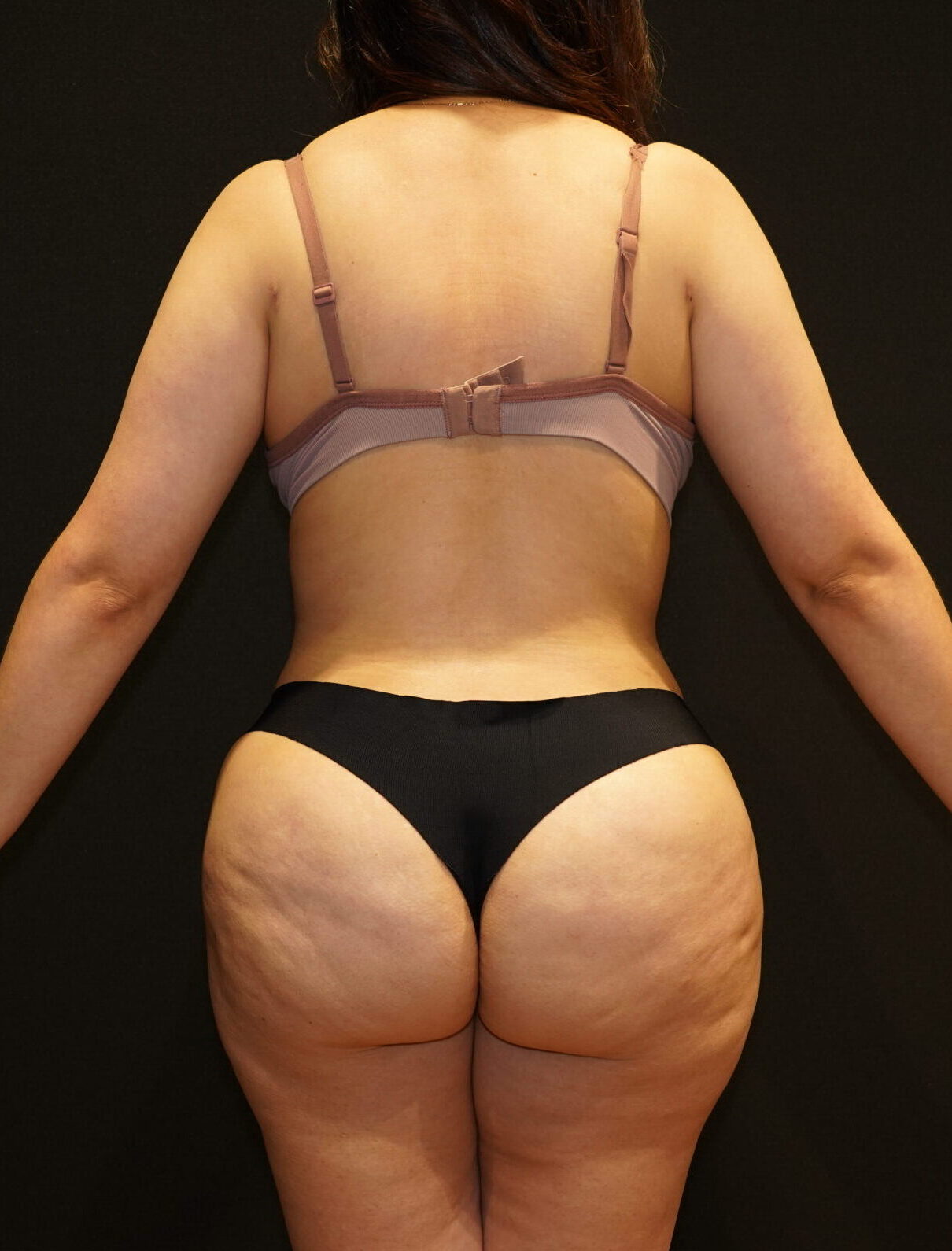 After photo - 180° view