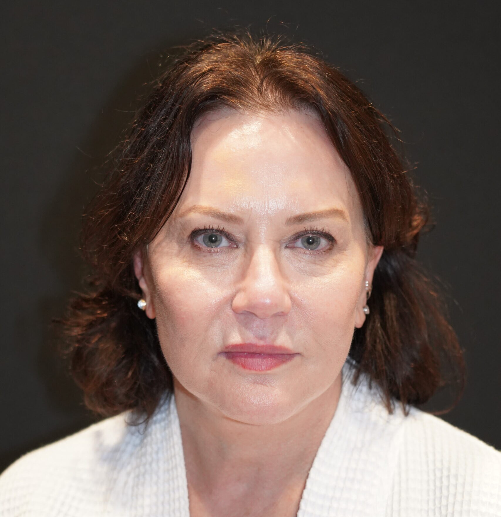 After photo - 0° view