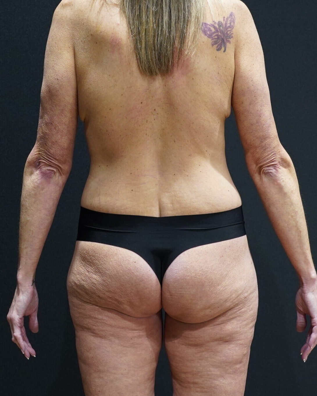 After photo - 180° view