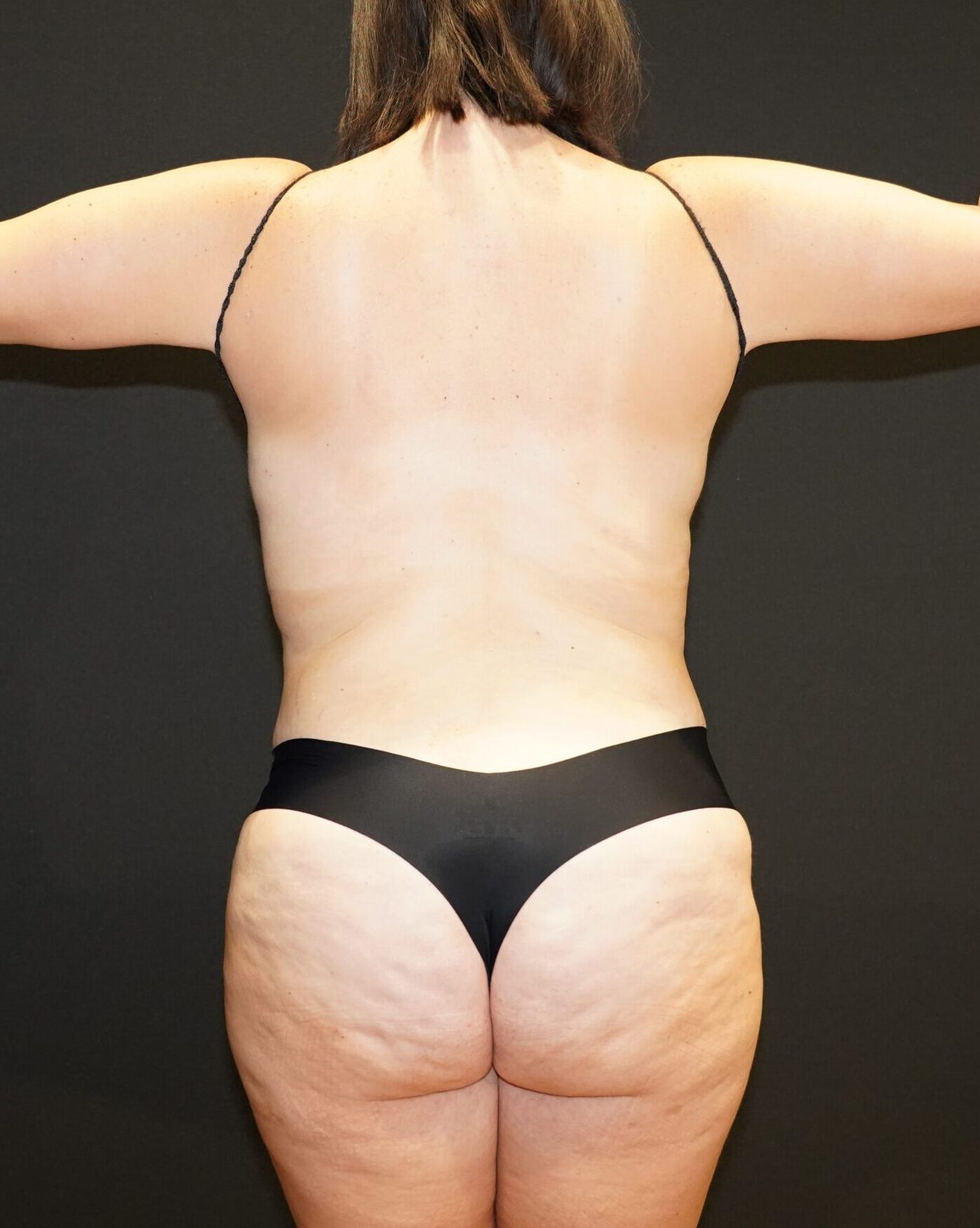 After photo - 180° view