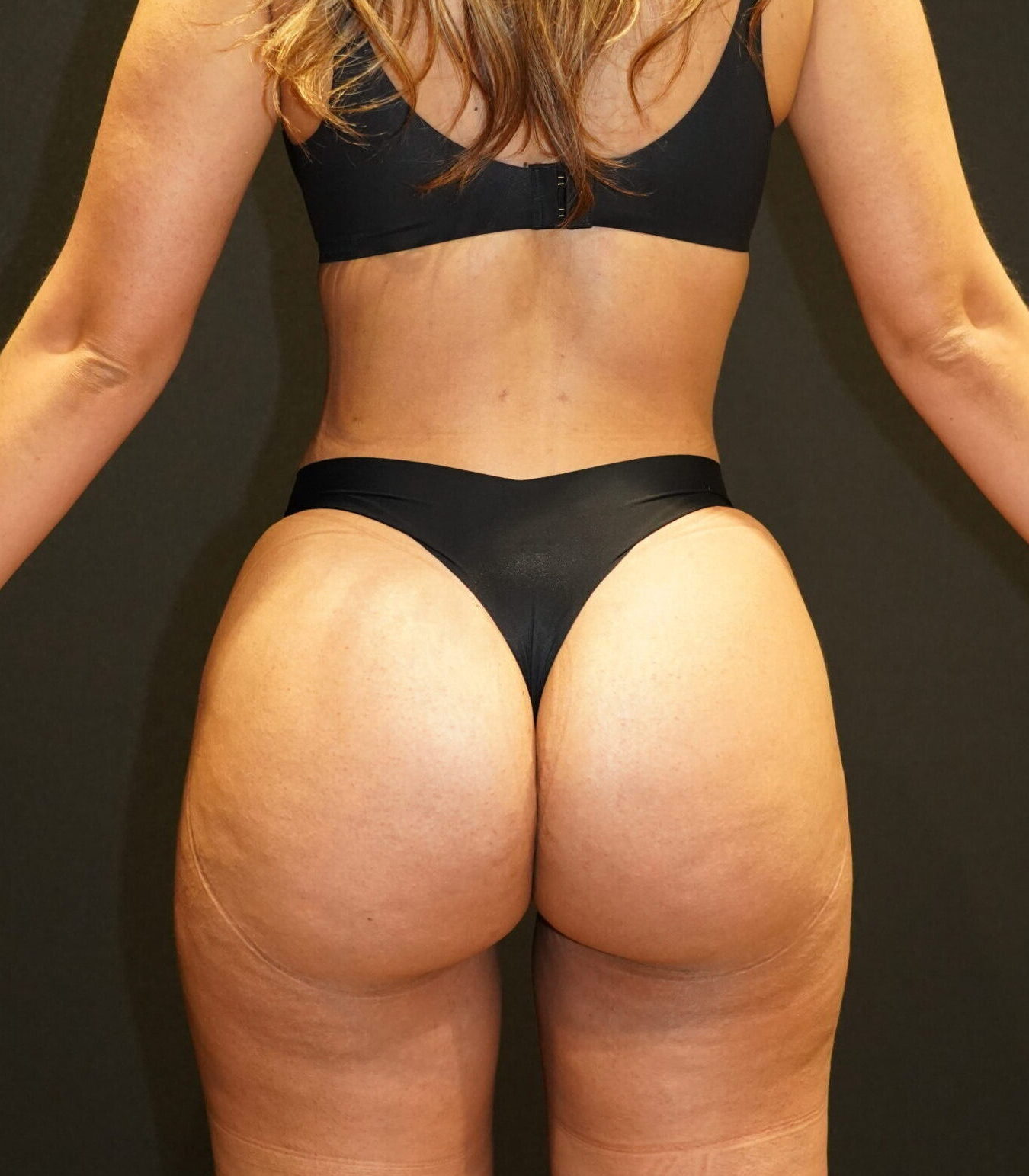 After photo - 180° view