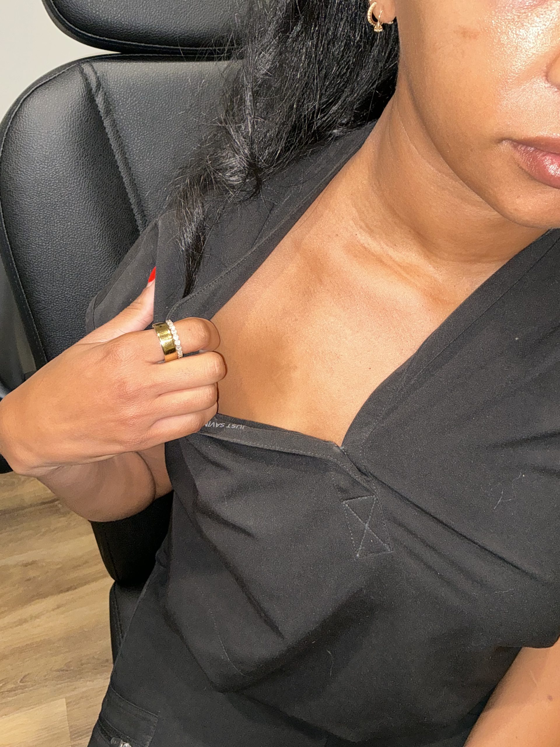 Case--7488 | After Tattoo Removal