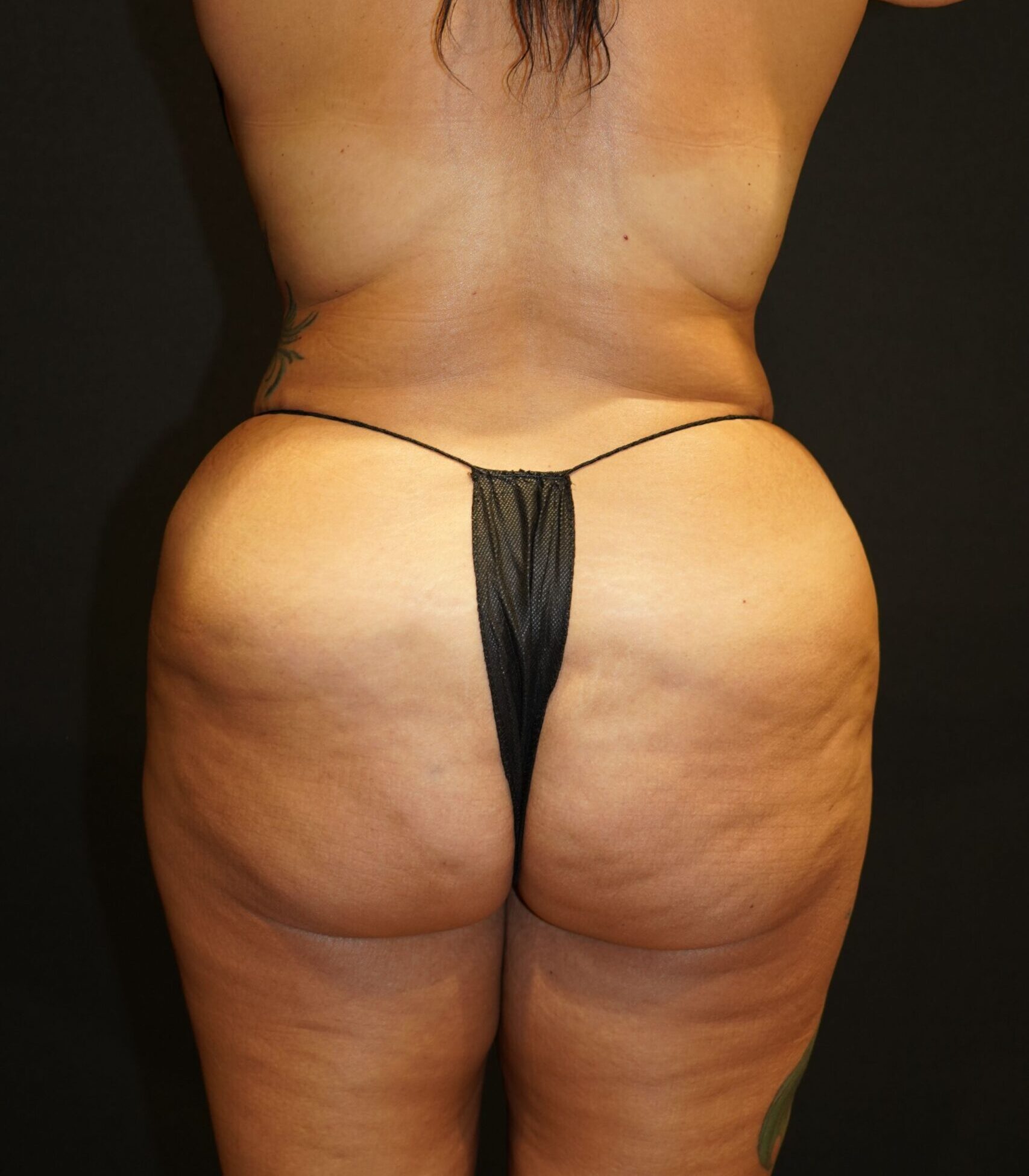 Before photo - 180° view