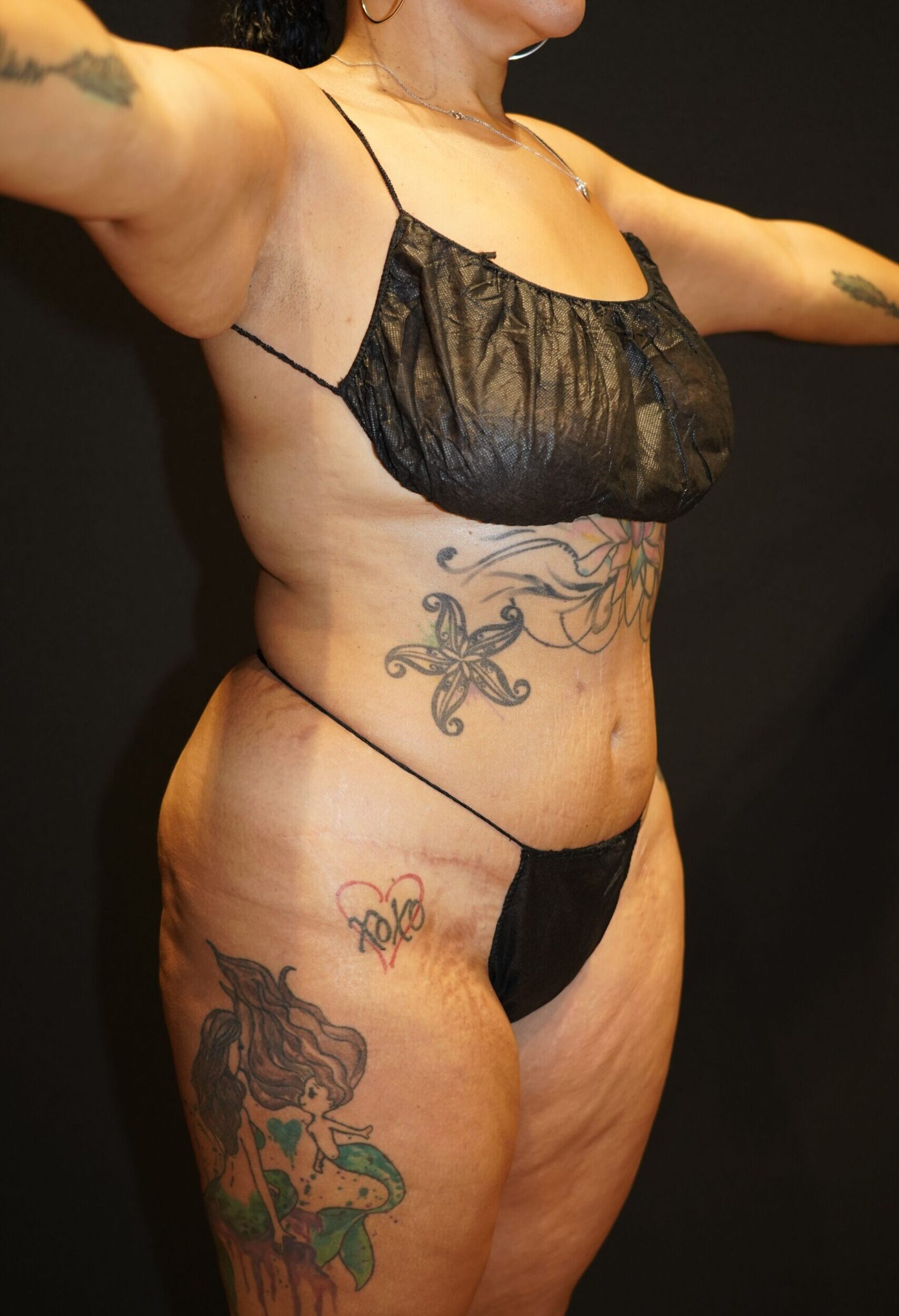 Before photo - 45° view